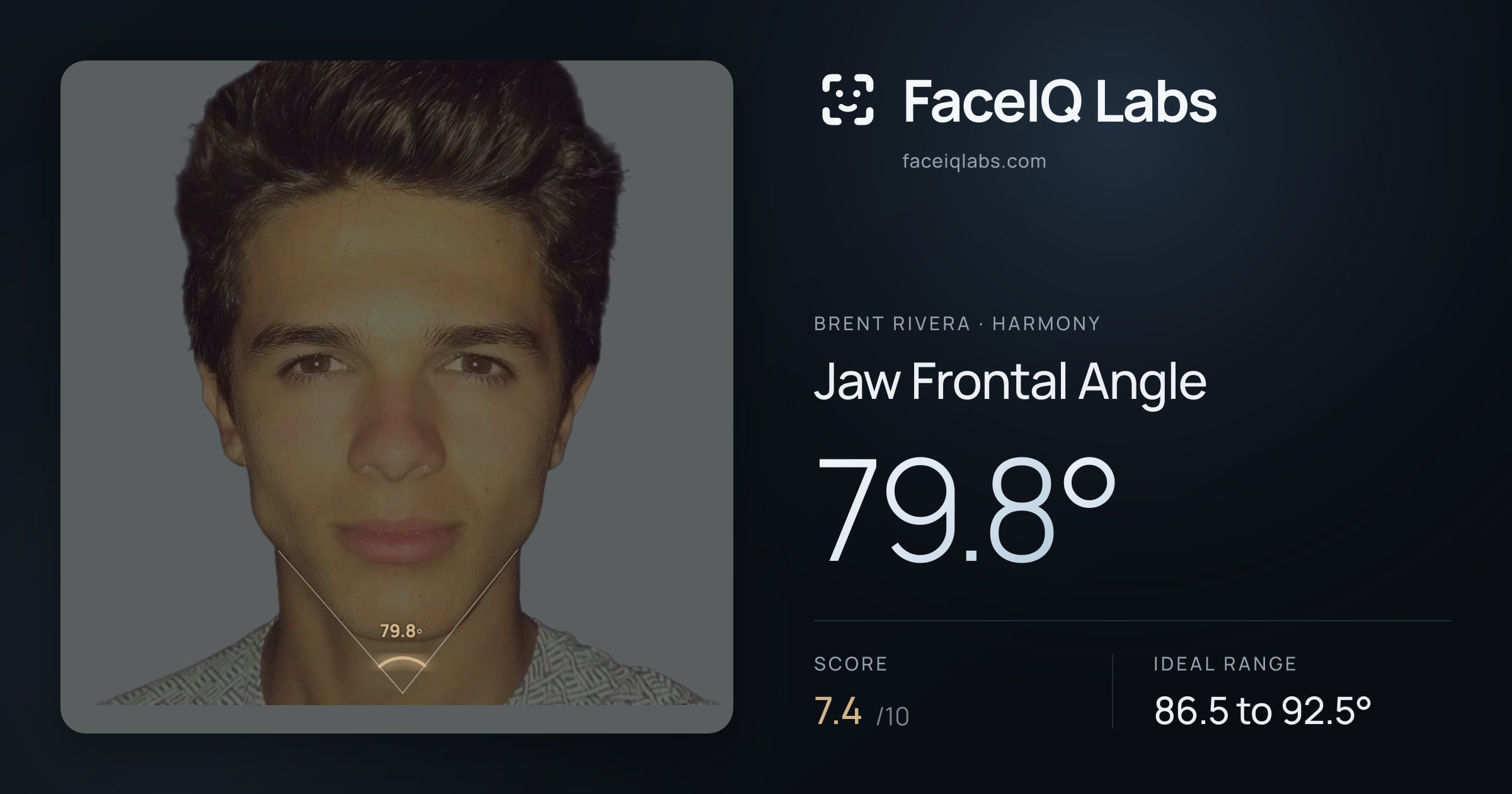 Brent Rivera Jaw Frontal Angle: 79.8°, drawn on the photo