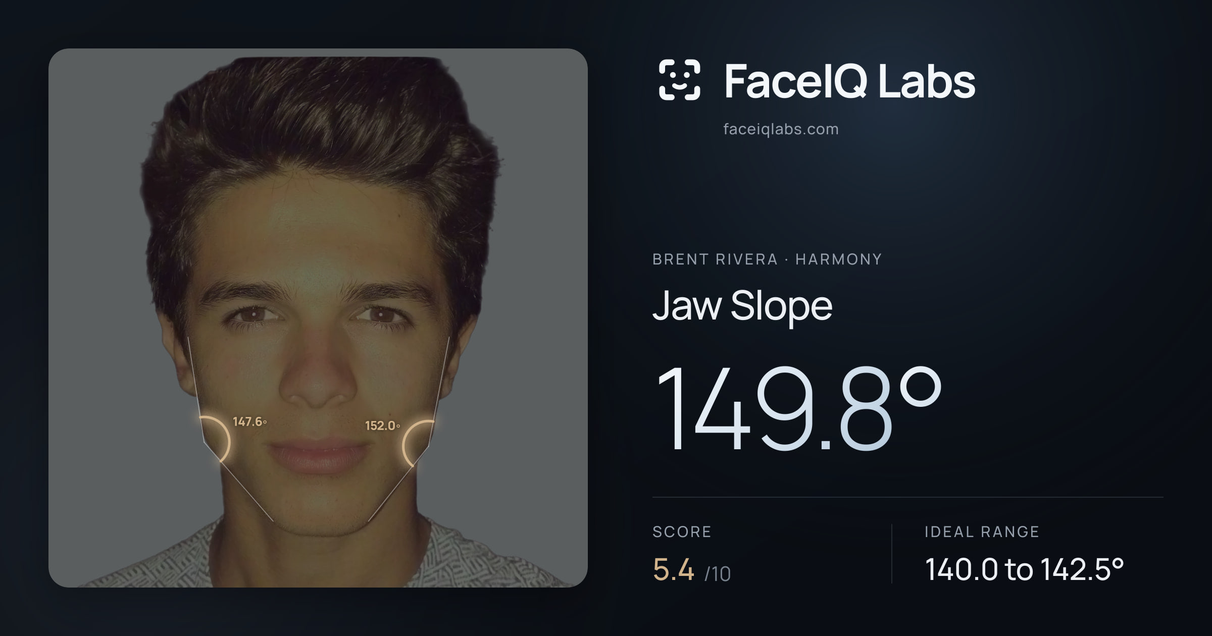 Brent Rivera Jaw Slope: 149.8°, drawn on the photo