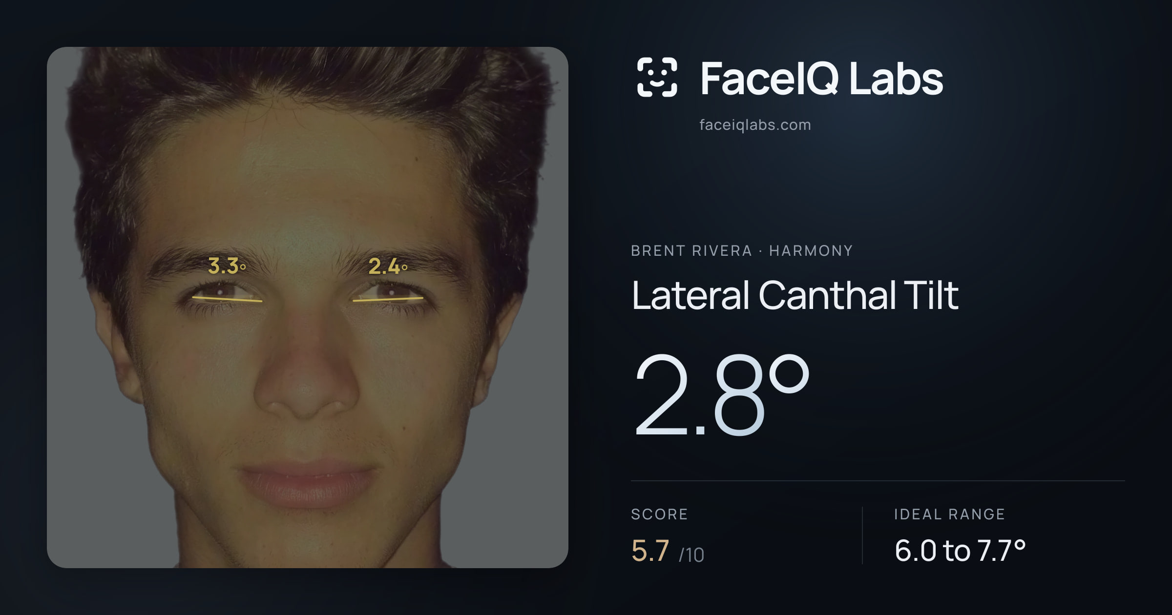 Brent Rivera Lateral Canthal Tilt: 2.8°, drawn on the photo