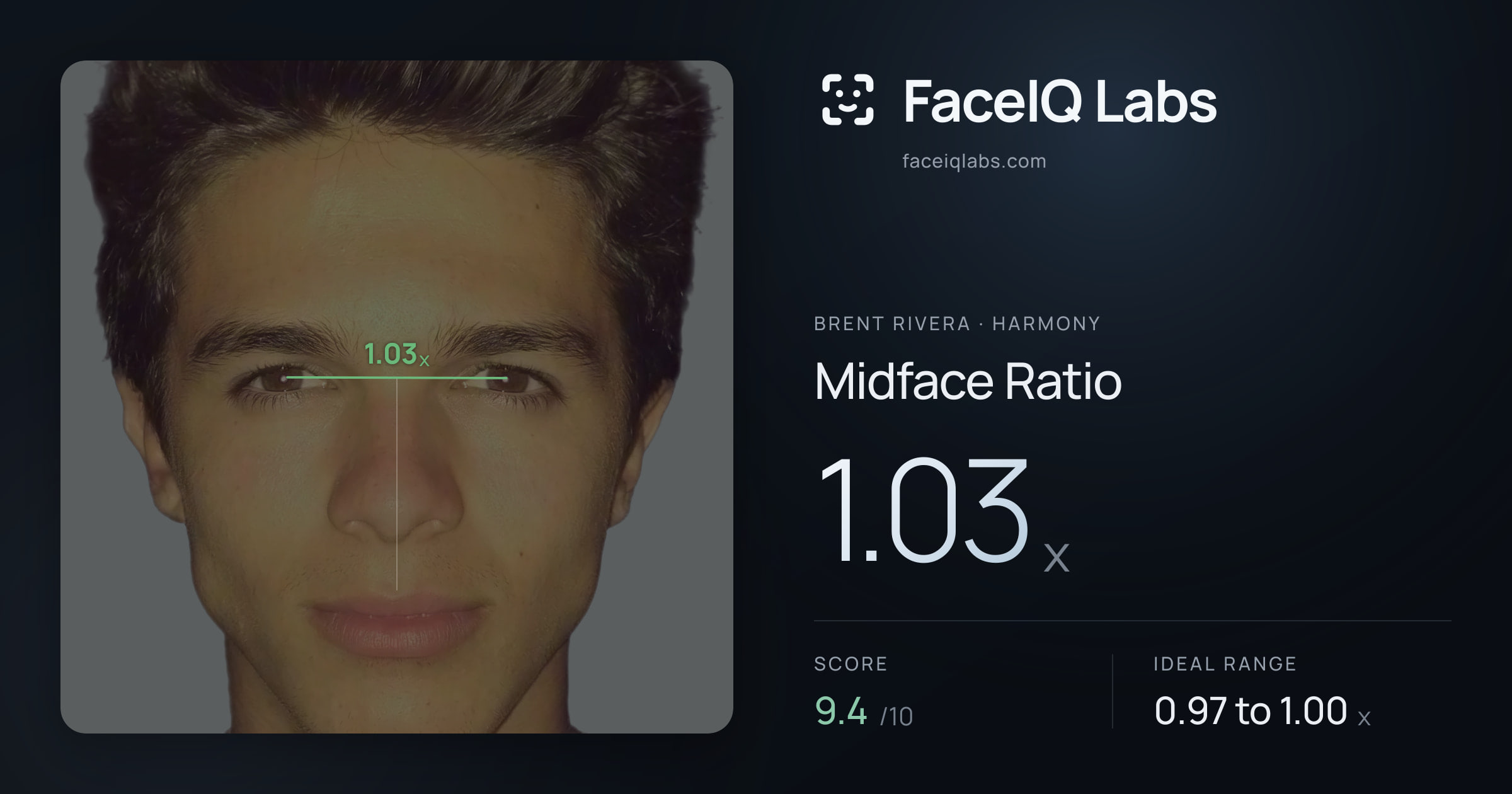 Brent Rivera Midface Ratio: 1.03x, drawn on the photo