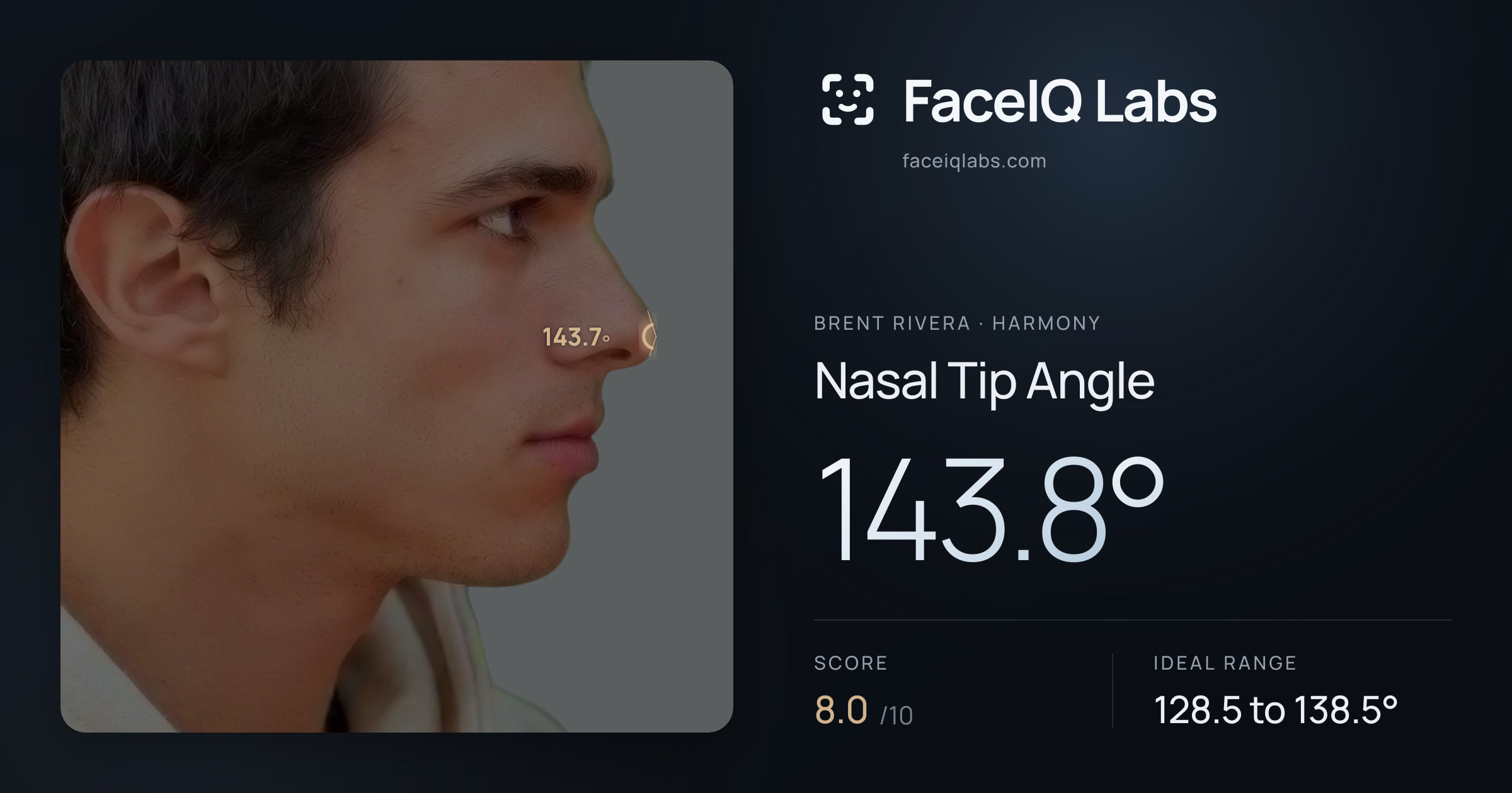 Brent Rivera Nasal Tip Angle: 143.8°, drawn on the photo