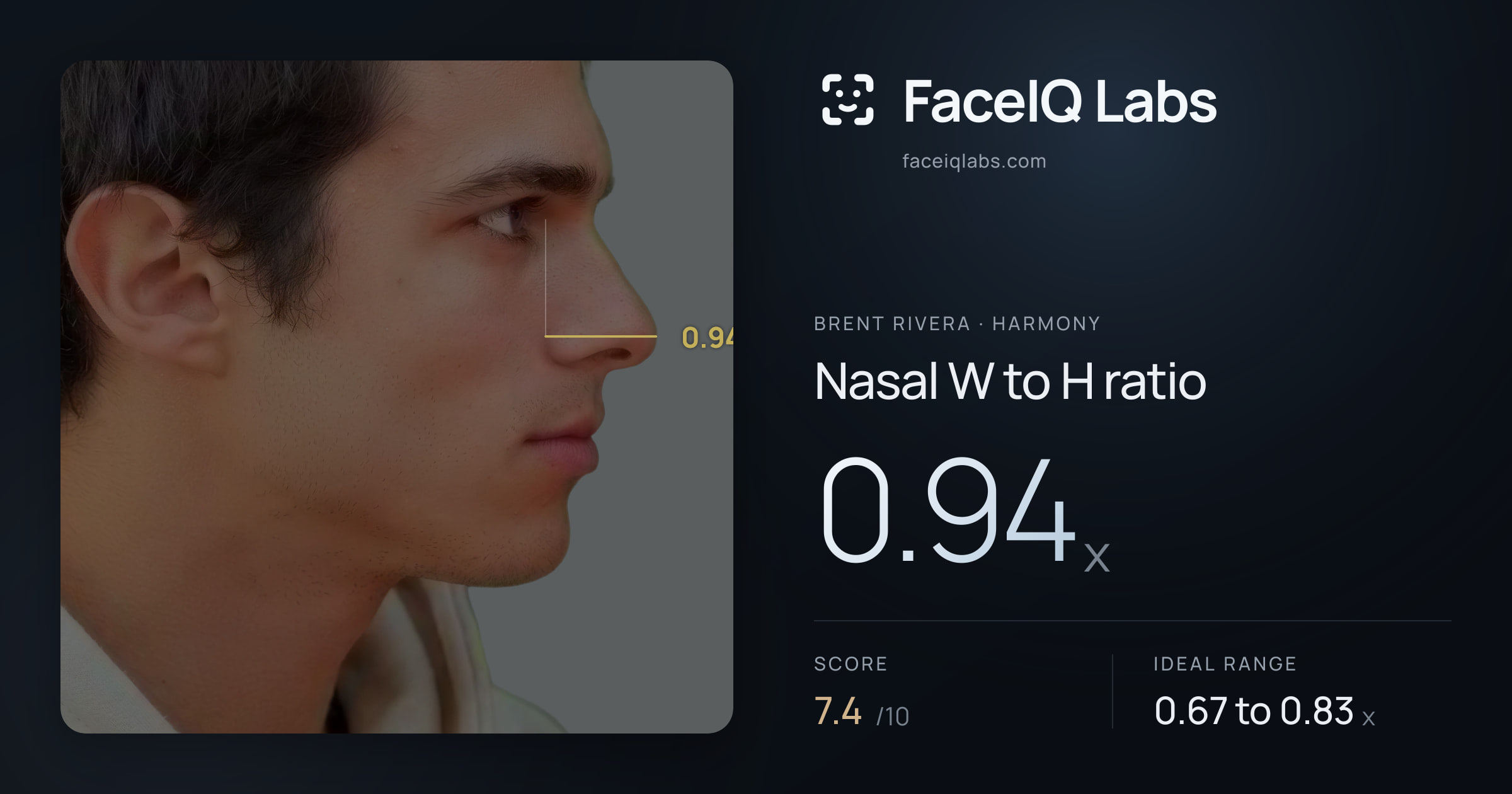 Brent Rivera Nasal W to H ratio: 0.94x, drawn on the photo