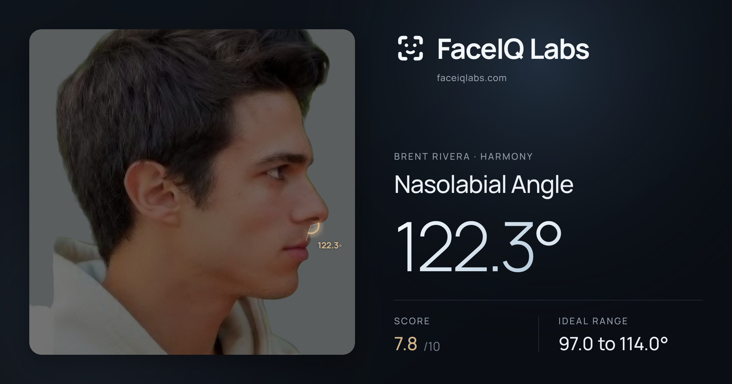 Brent Rivera Nasolabial Angle: 122.3°, drawn on the photo