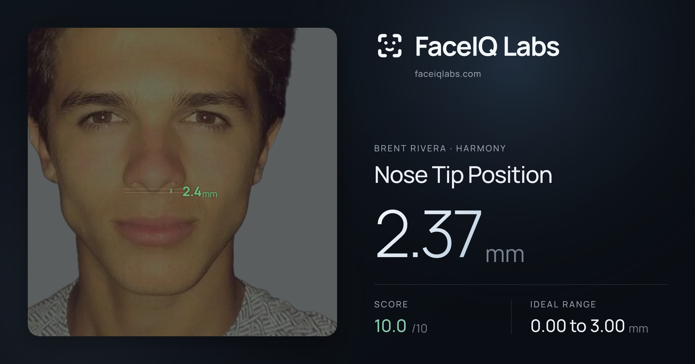 Brent Rivera Nose Tip Position: 2.37mm, drawn on the photo