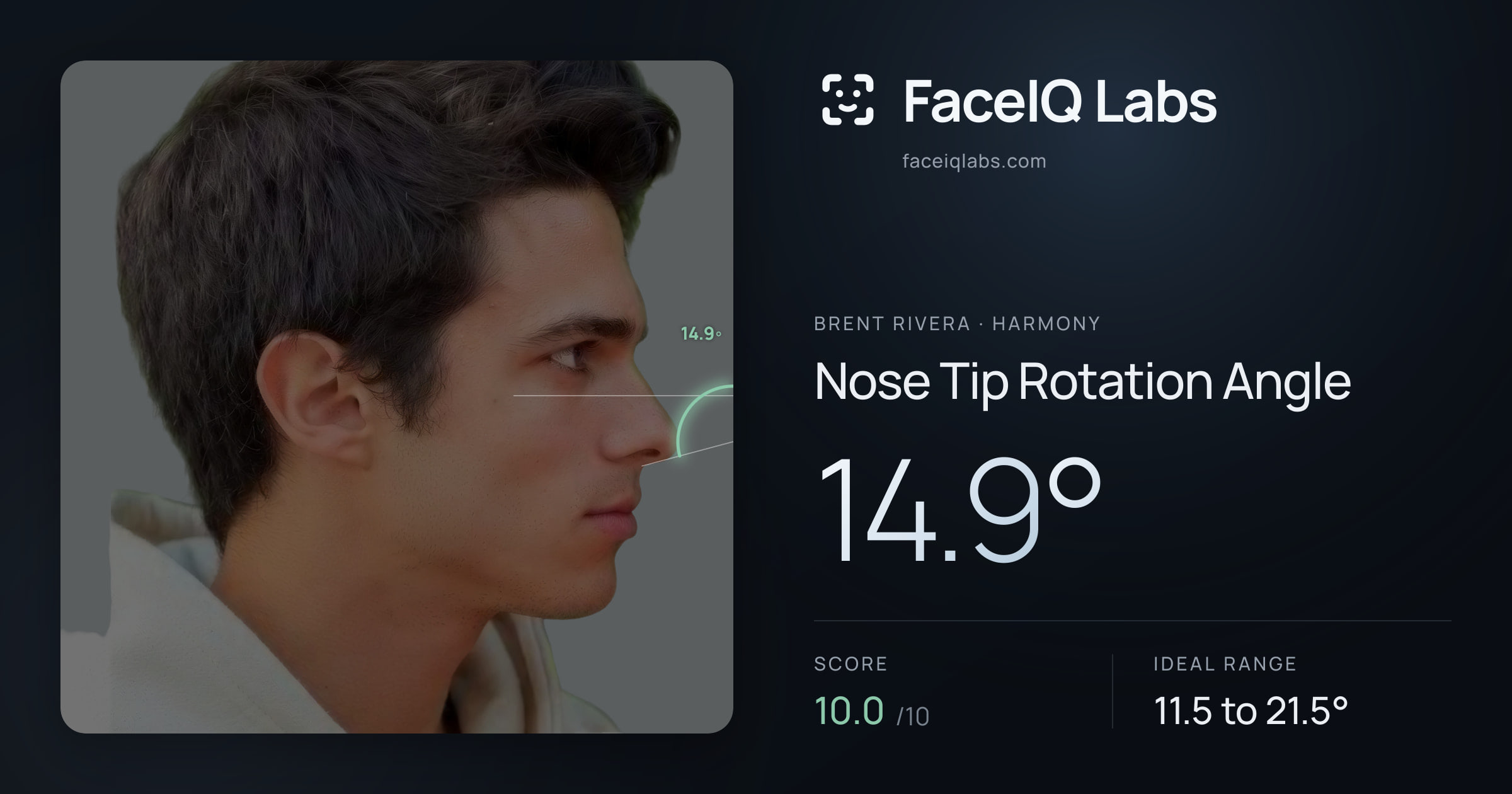 Brent Rivera Nose Tip Rotation Angle: 14.9°, drawn on the photo