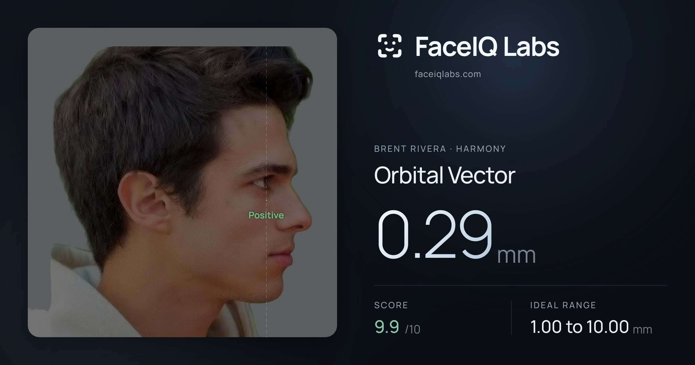 Brent Rivera Orbital Vector: 0.29mm, drawn on the photo