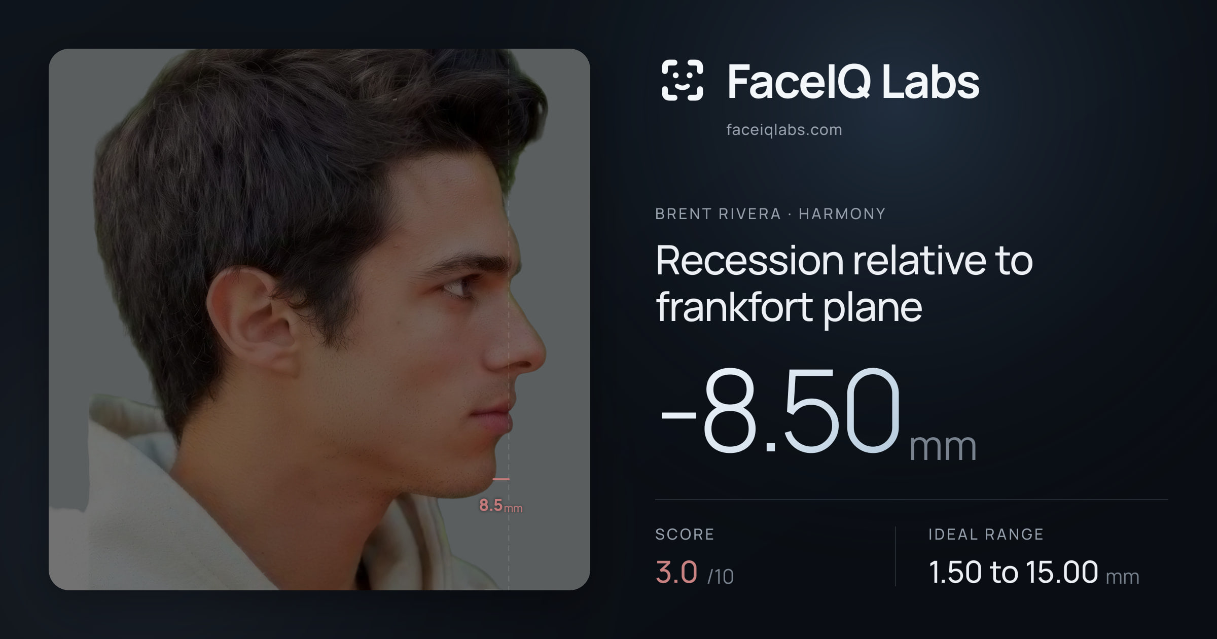 Brent Rivera Recession relative to frankfort plane: -8.50mm, drawn on the photo