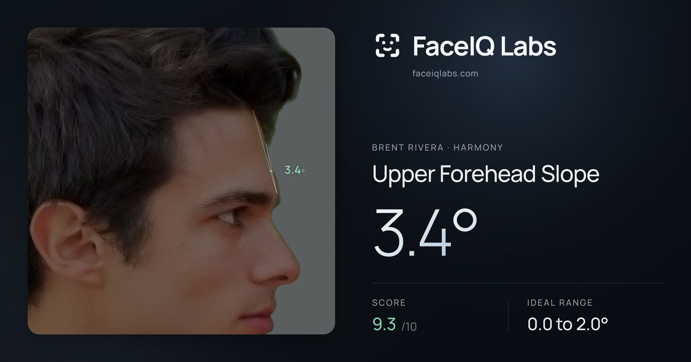 Brent Rivera Upper Forehead Slope: 3.4°, drawn on the photo