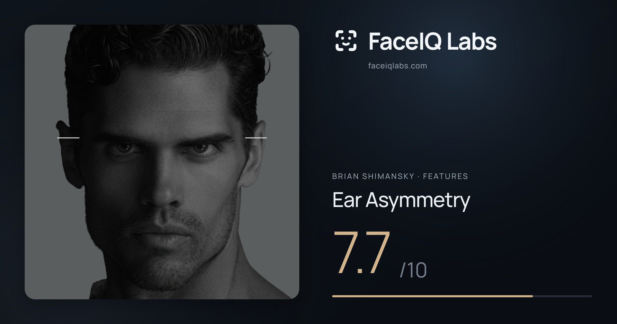 Brian Shimansky Ear Asymmetry: 7.7/10, drawn on the photo