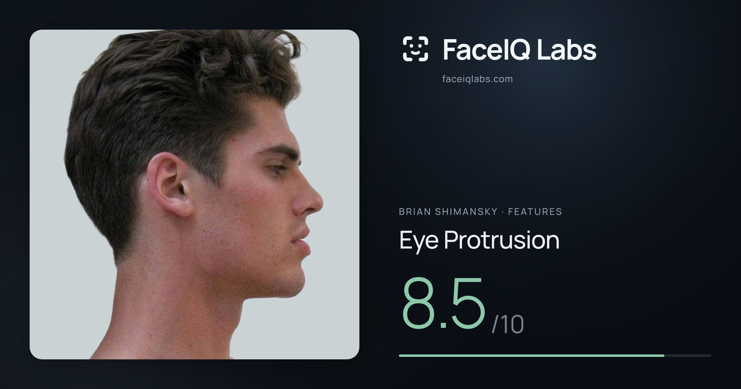 Brian Shimansky Eye Protrusion: 8.5/10, drawn on the photo