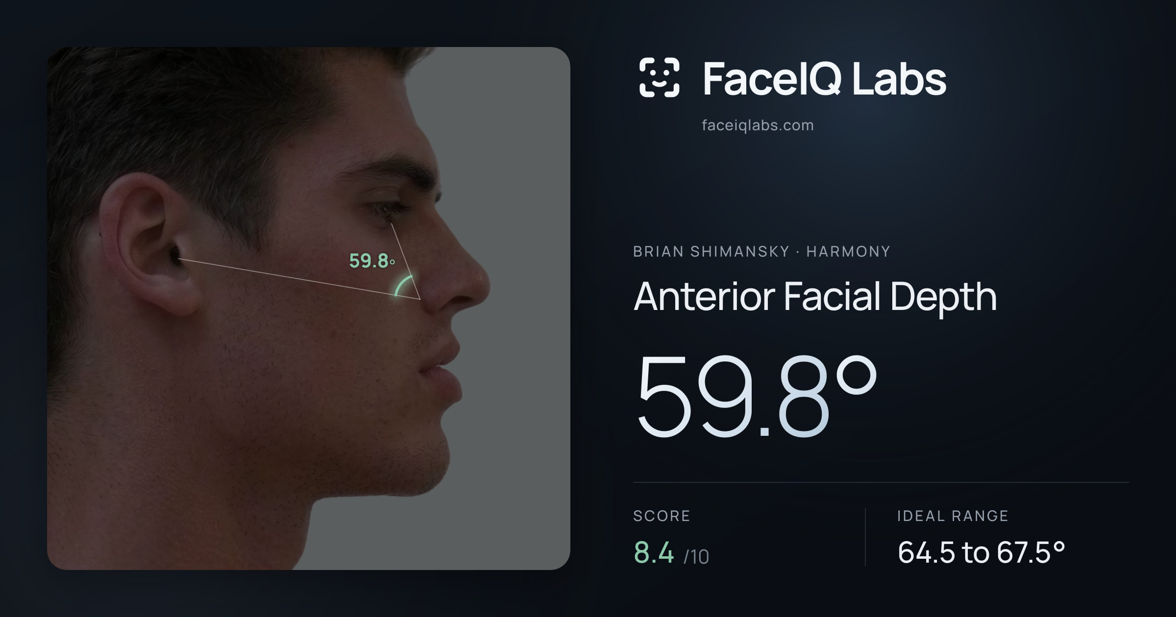 Brian Shimansky Anterior Facial Depth: 59.8°, drawn on the photo