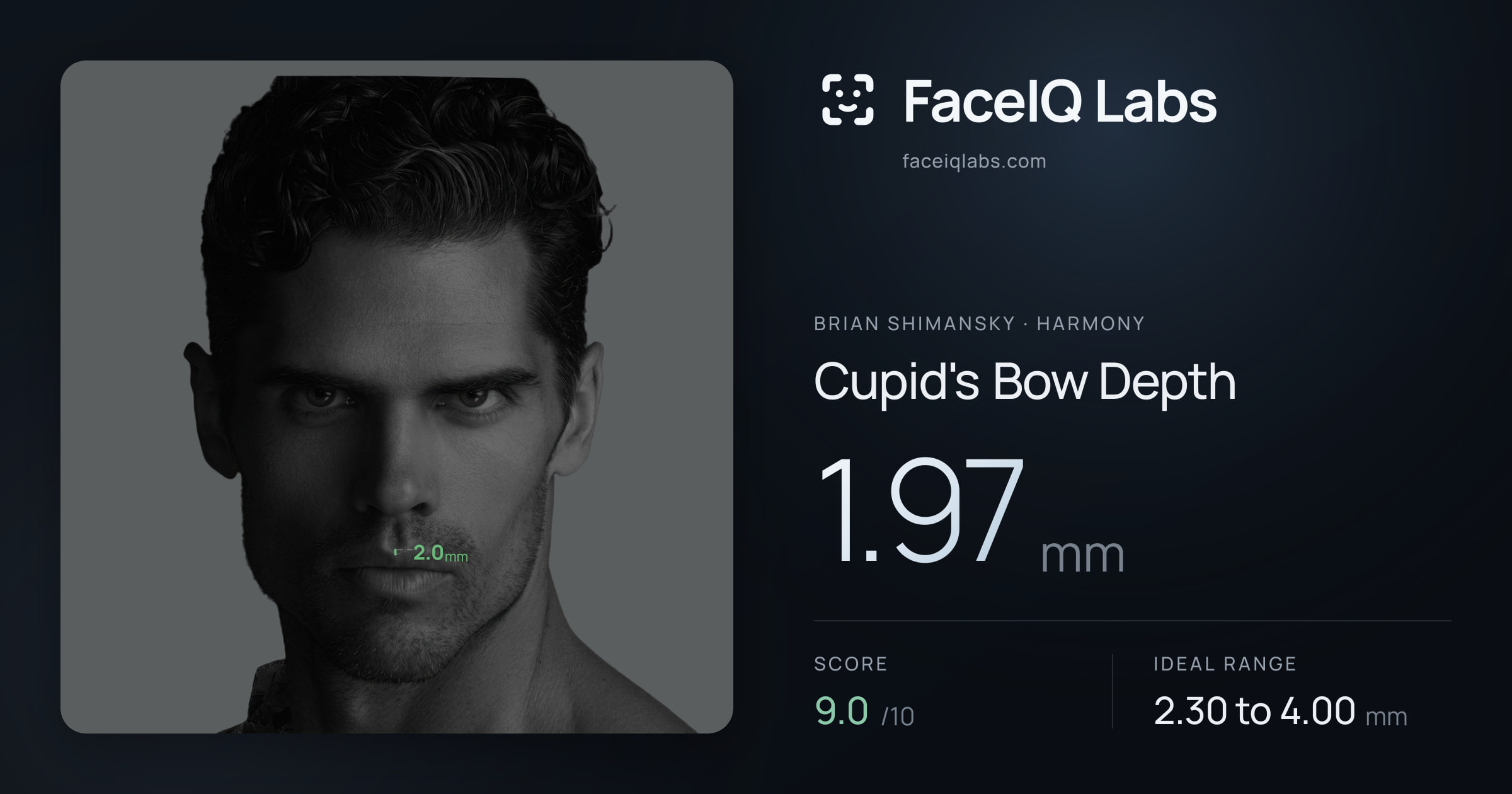 Brian Shimansky Cupid's Bow Depth: 1.97mm, drawn on the photo