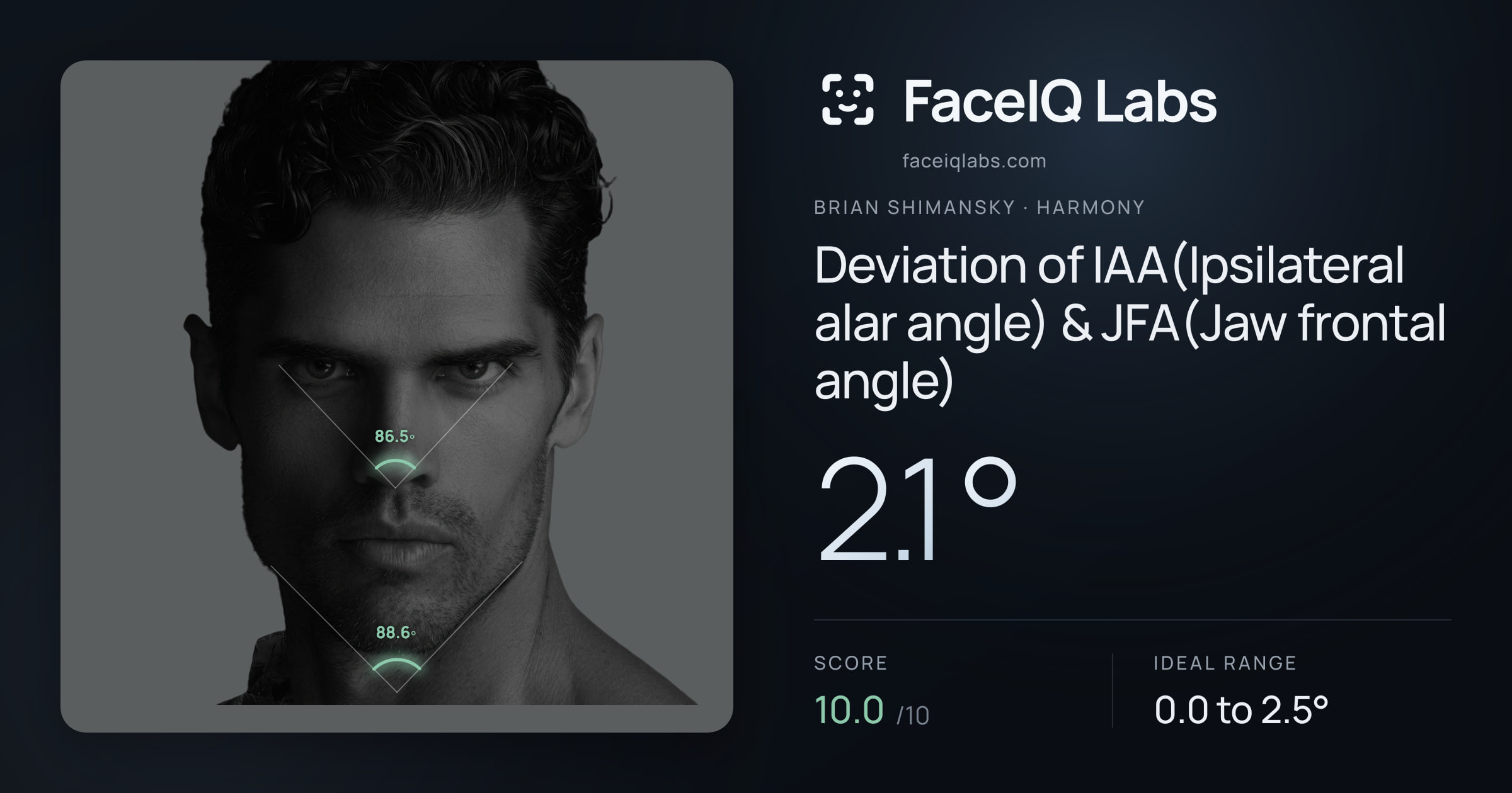 Brian Shimansky Deviation of IAA(Ipsilateral alar angle) & JFA(Jaw frontal angle): 2.1°, drawn on the photo