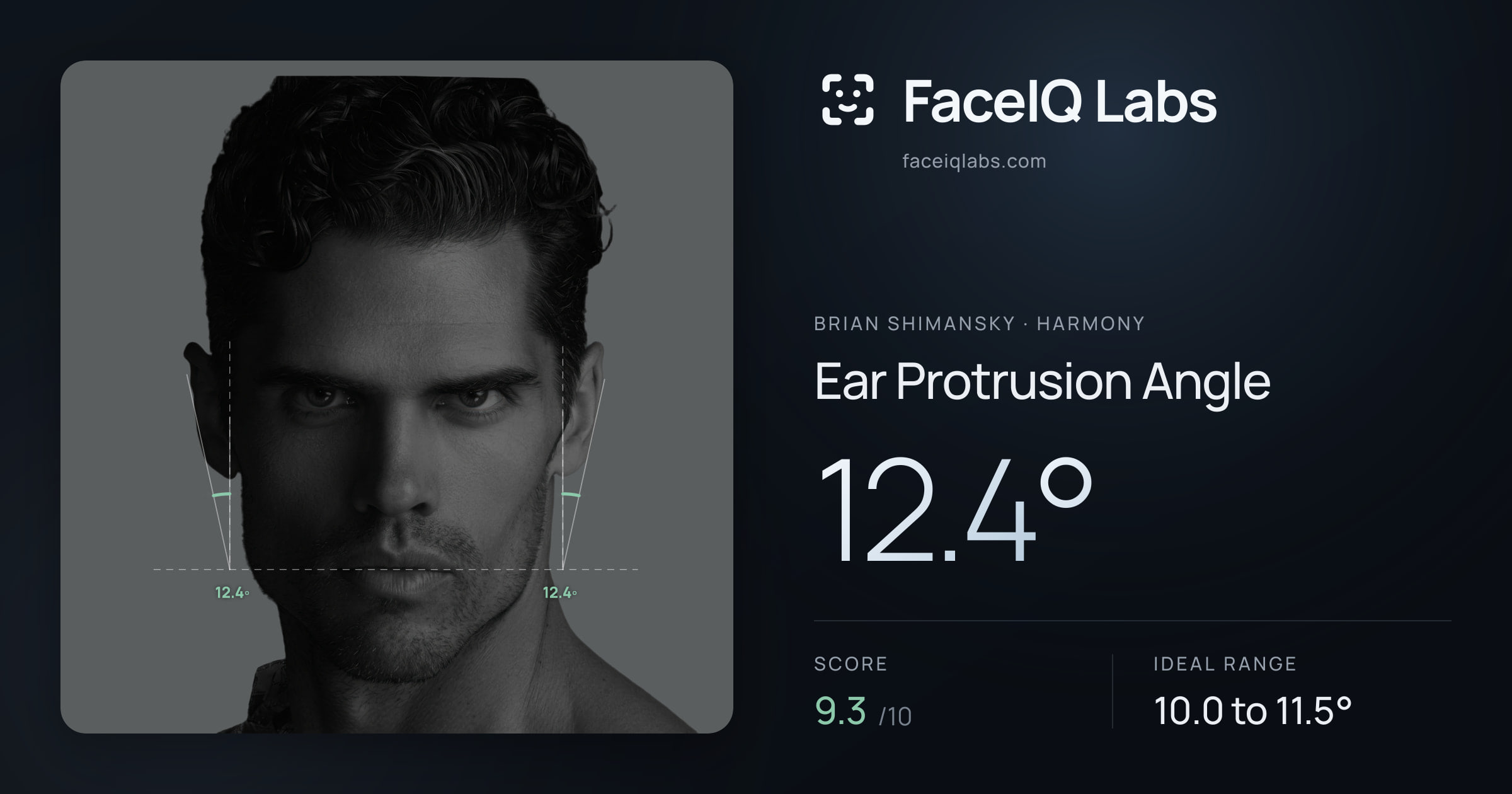 Brian Shimansky Ear Protrusion Angle: 12.4°, drawn on the photo