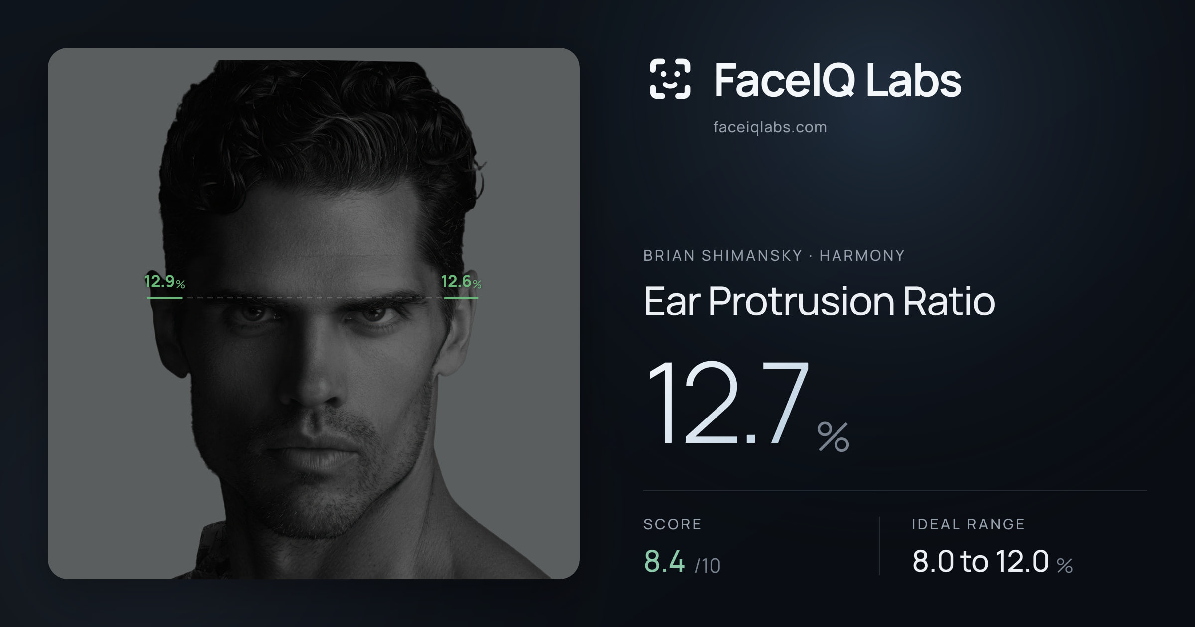 Brian Shimansky Ear Protrusion Ratio: 12.7%, drawn on the photo