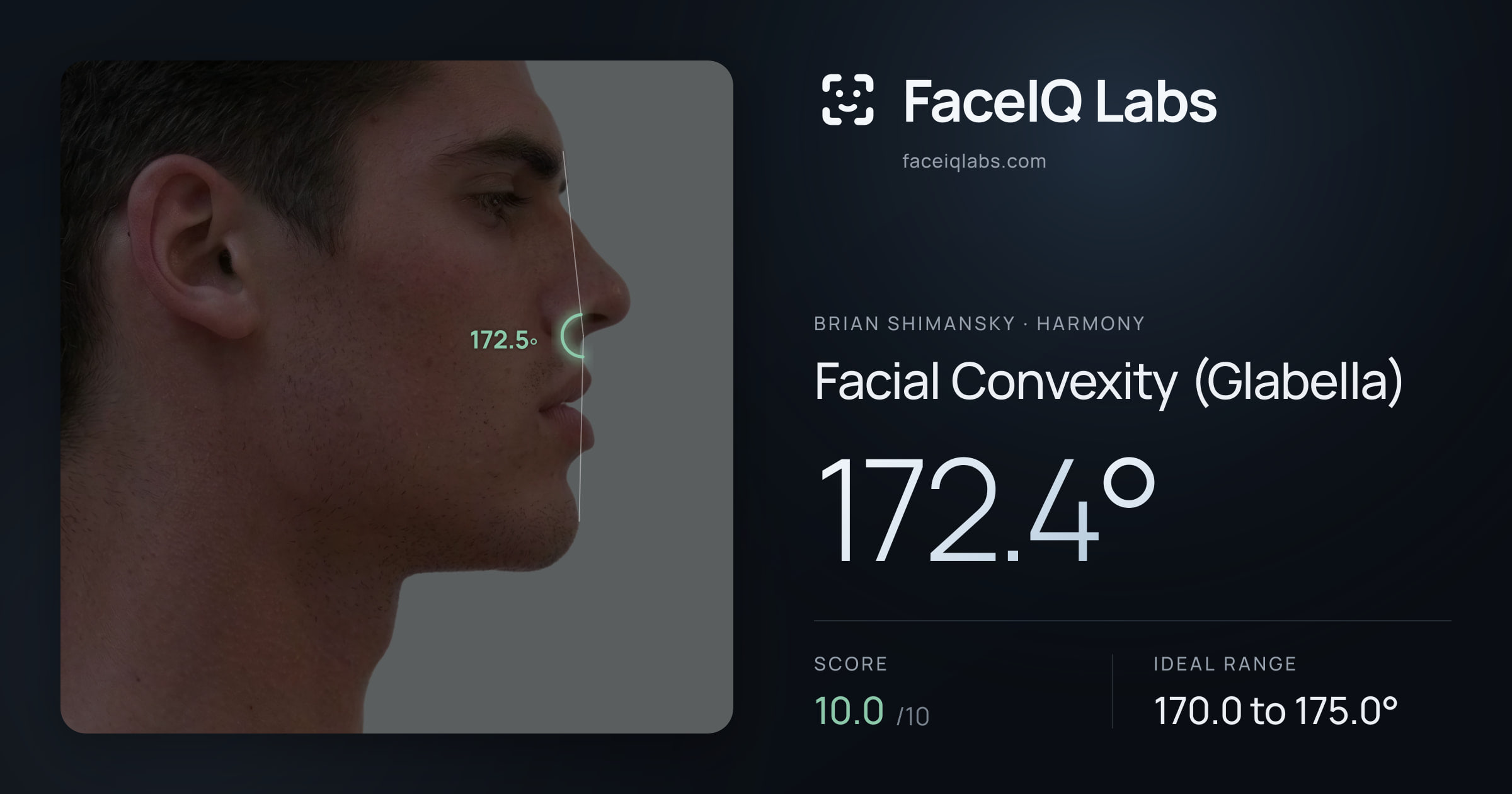 Brian Shimansky Facial Convexity (Glabella): 171.4°, drawn on the photo