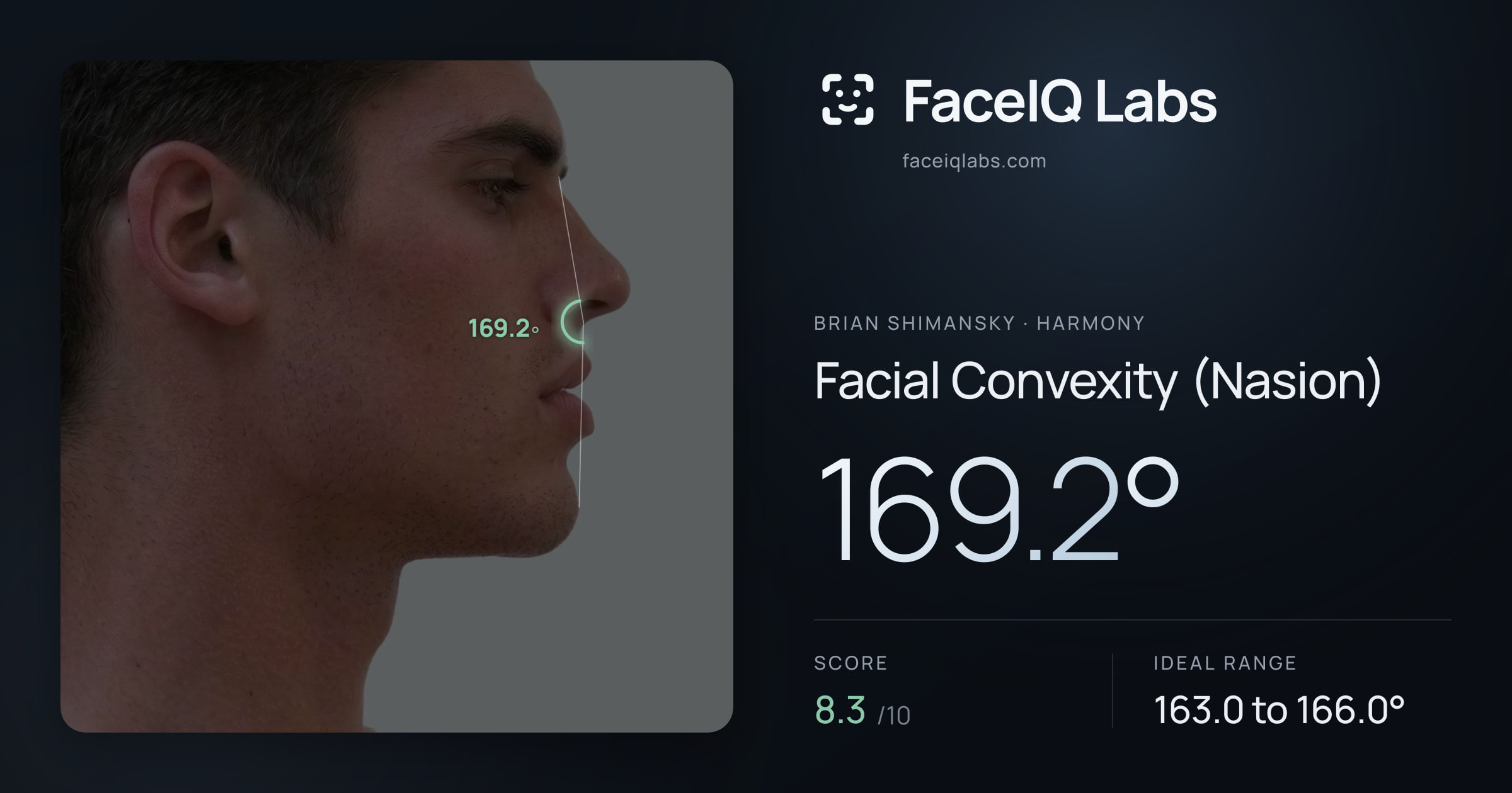 Brian Shimansky Facial Convexity (Nasion): 166.1°, drawn on the photo