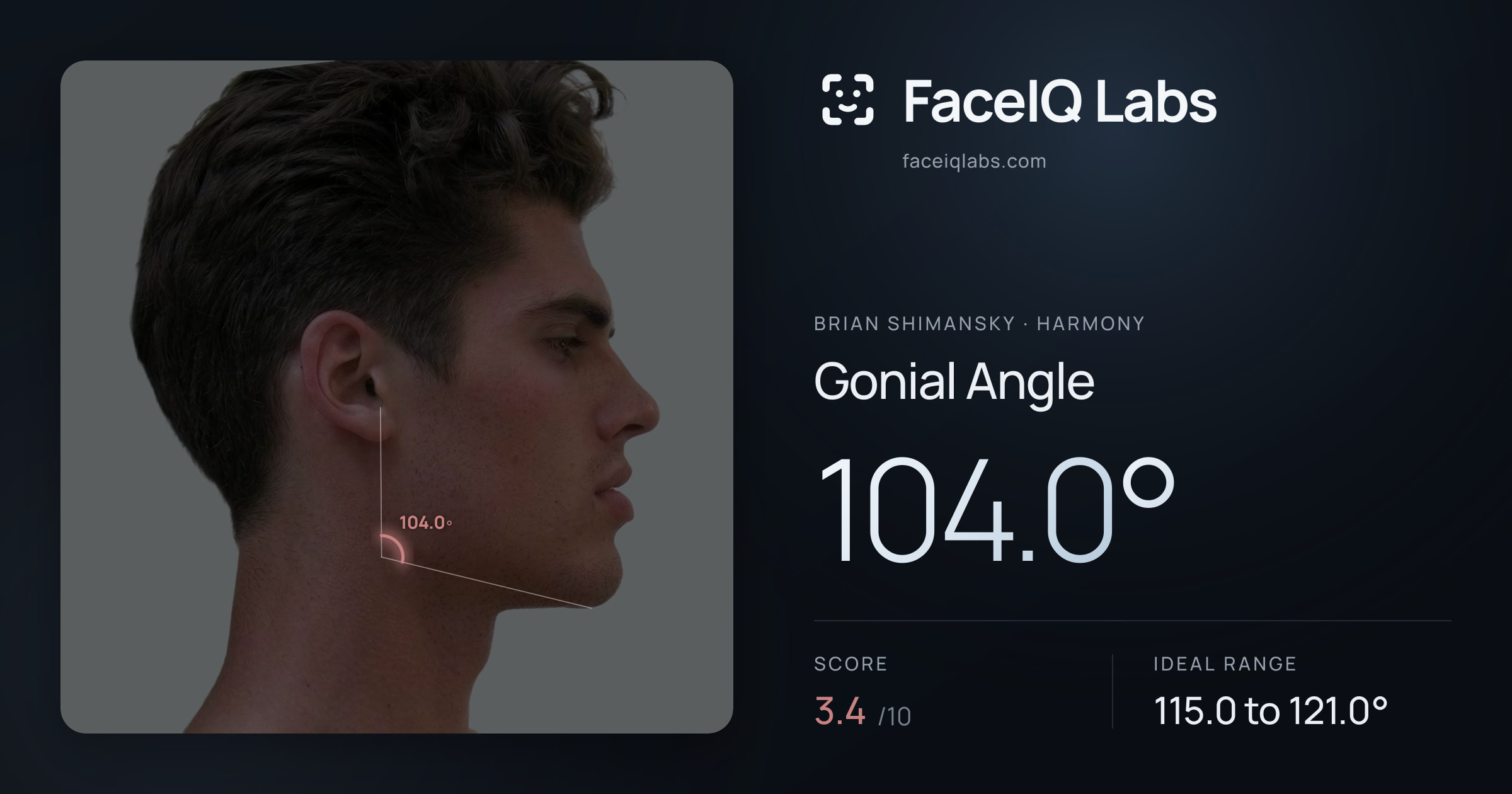 Brian Shimansky Gonial Angle: 104.0°, drawn on the photo