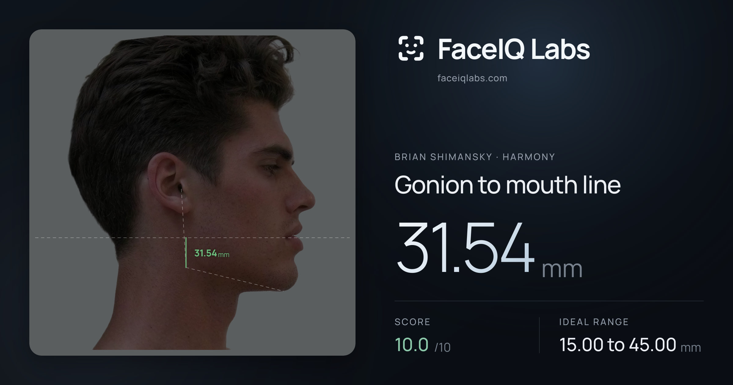 Brian Shimansky Gonion to mouth line: 23.94mm, drawn on the photo