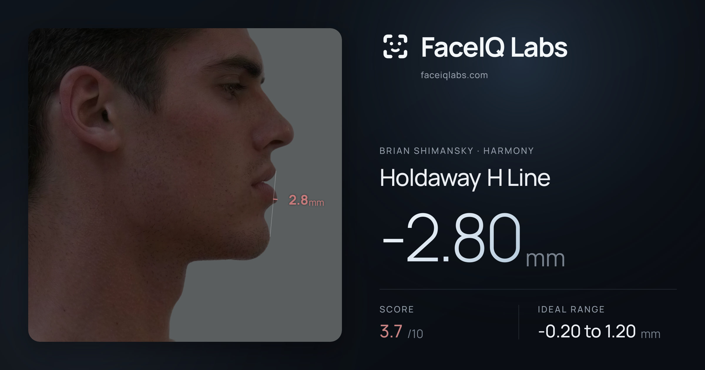 Brian Shimansky Holdaway H Line: -1.97mm, drawn on the photo