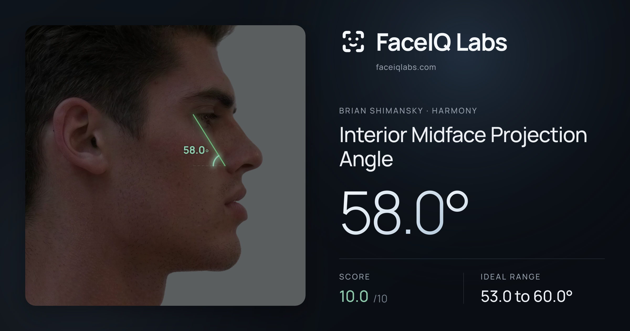 Brian Shimansky Interior Midface Projection Angle: 58.0°, drawn on the photo