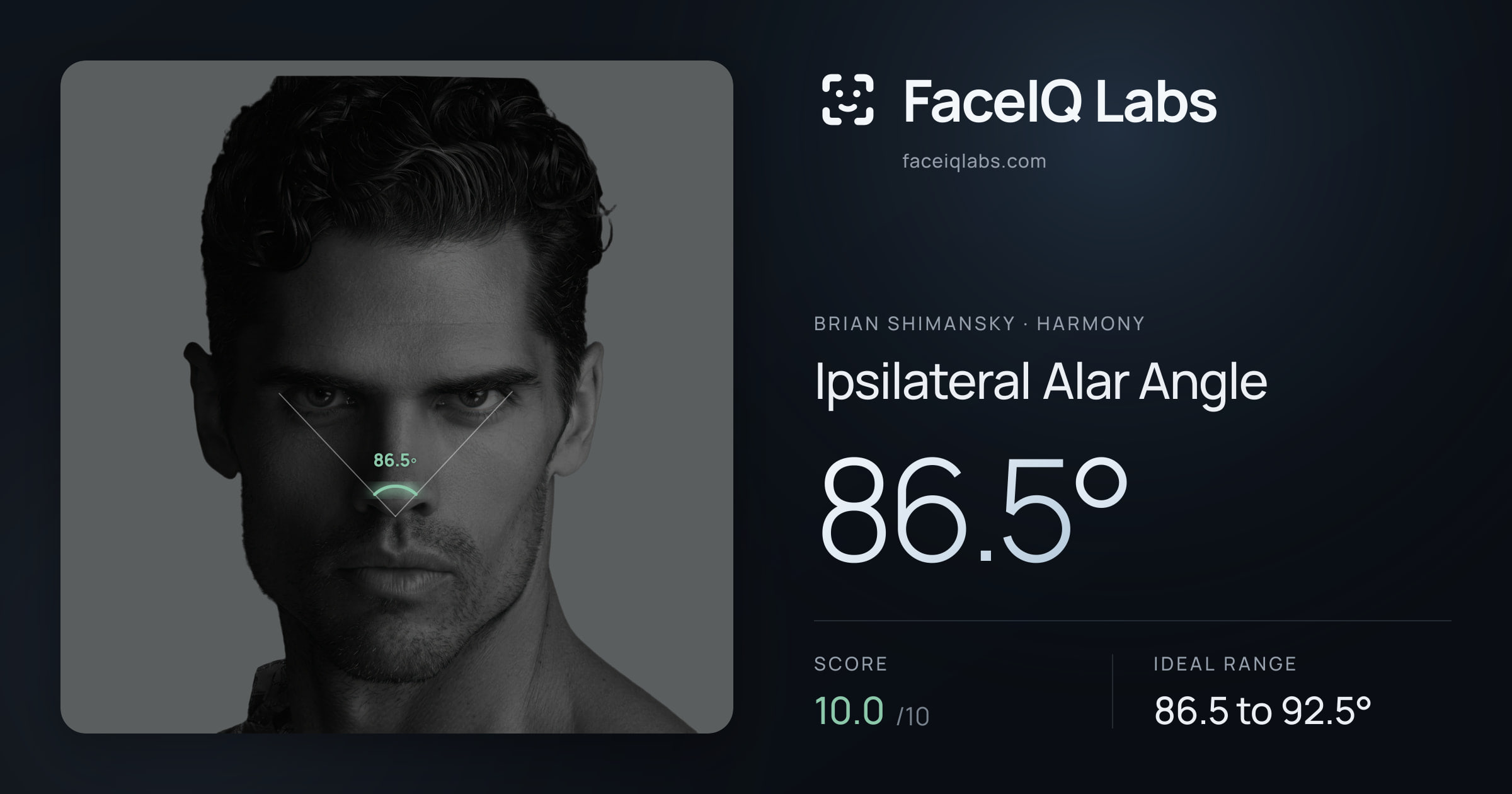 Brian Shimansky Ipsilateral Alar Angle: 86.5°, drawn on the photo