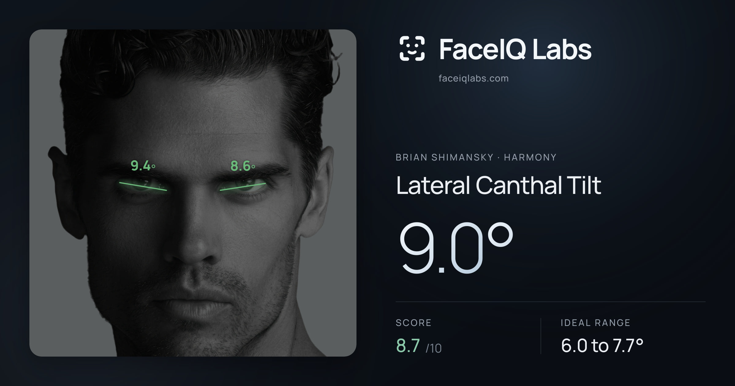 Brian Shimansky Lateral Canthal Tilt: 9.0°, drawn on the photo