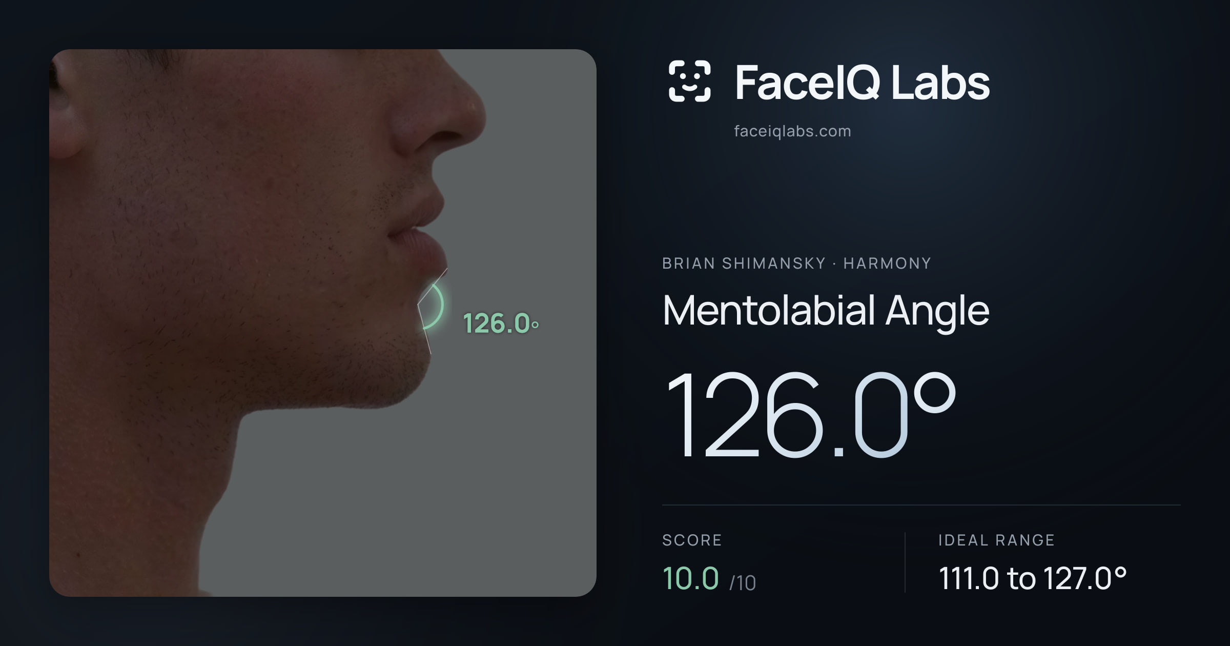 Brian Shimansky Mentolabial Angle: 132.4°, drawn on the photo