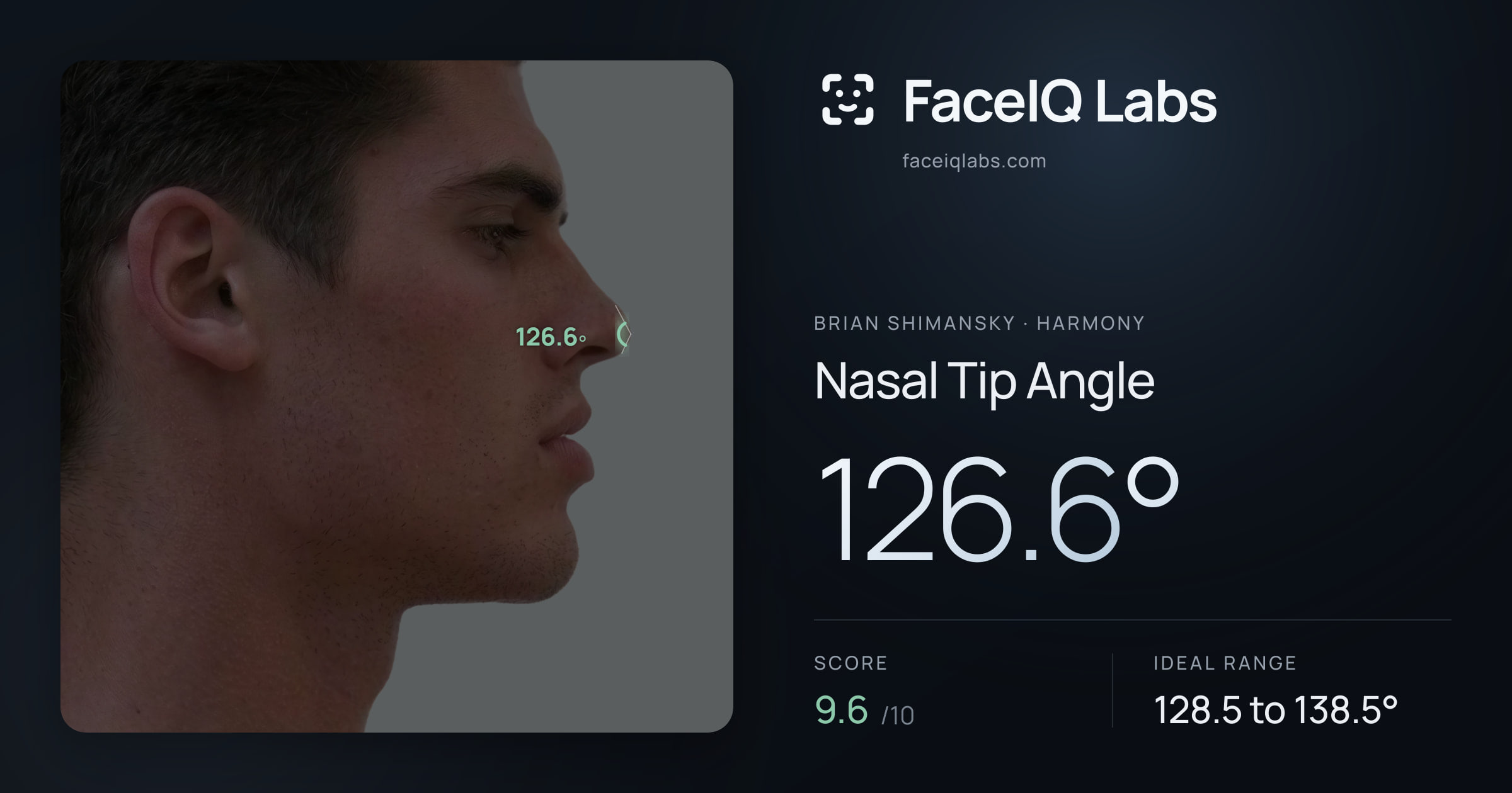 Brian Shimansky Nasal Tip Angle: 126.8°, drawn on the photo