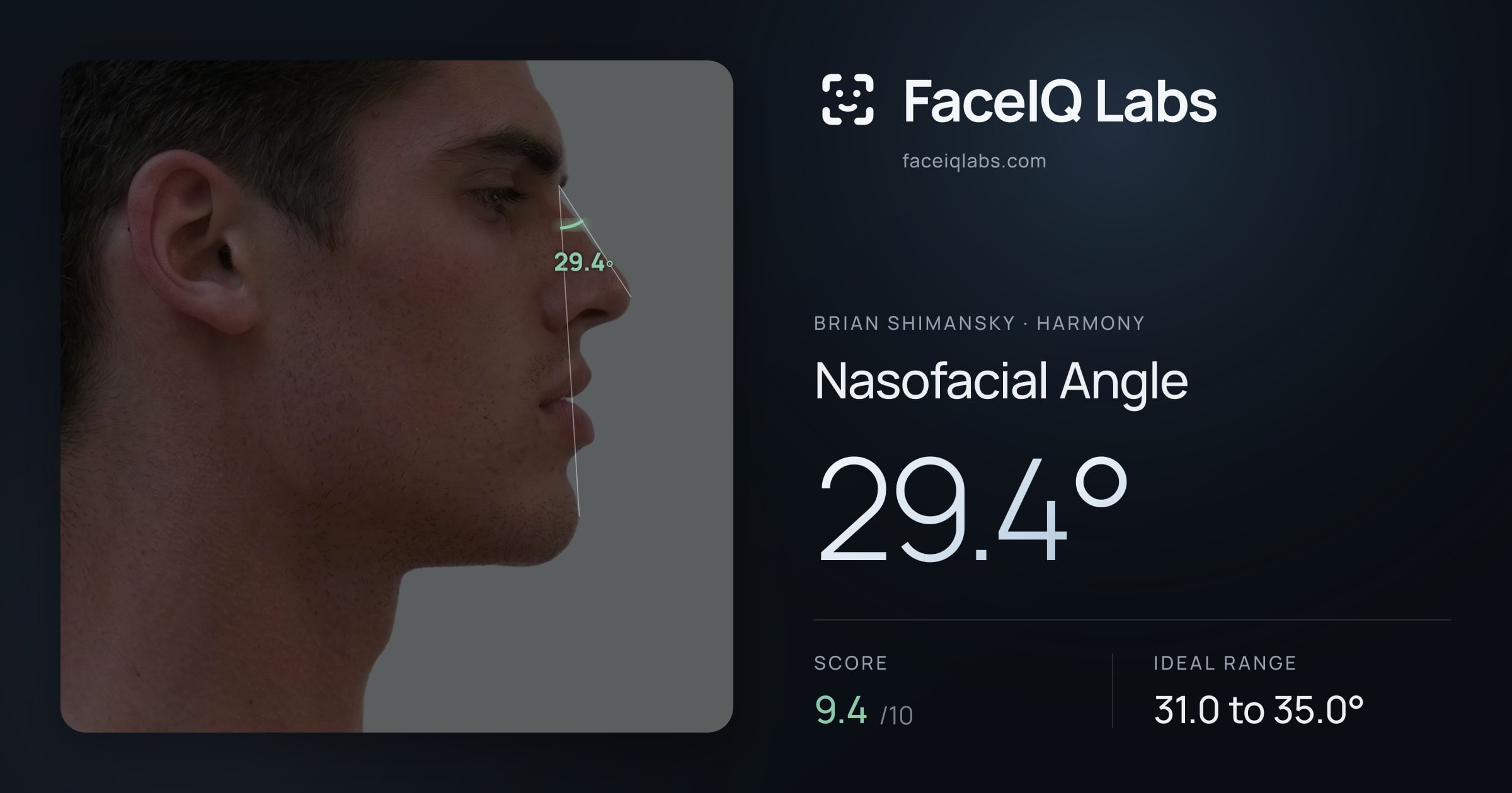 Brian Shimansky Nasofacial Angle: 31.9°, drawn on the photo