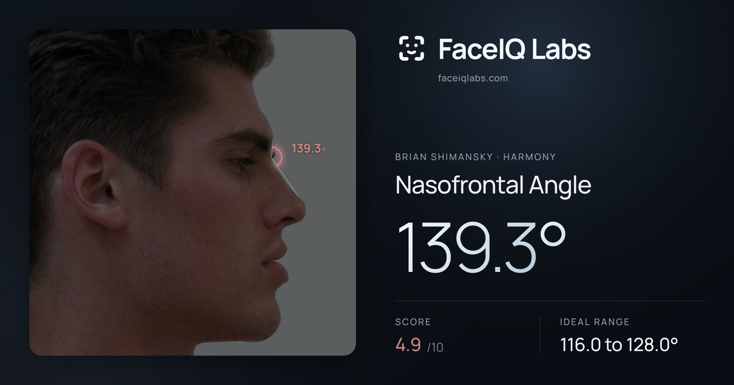 Brian Shimansky Nasofrontal Angle: 129.9°, drawn on the photo