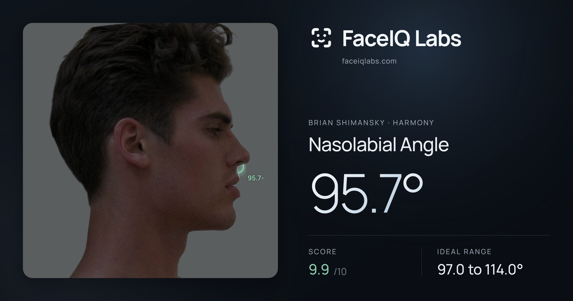 Brian Shimansky Nasolabial Angle: 100.0°, drawn on the photo