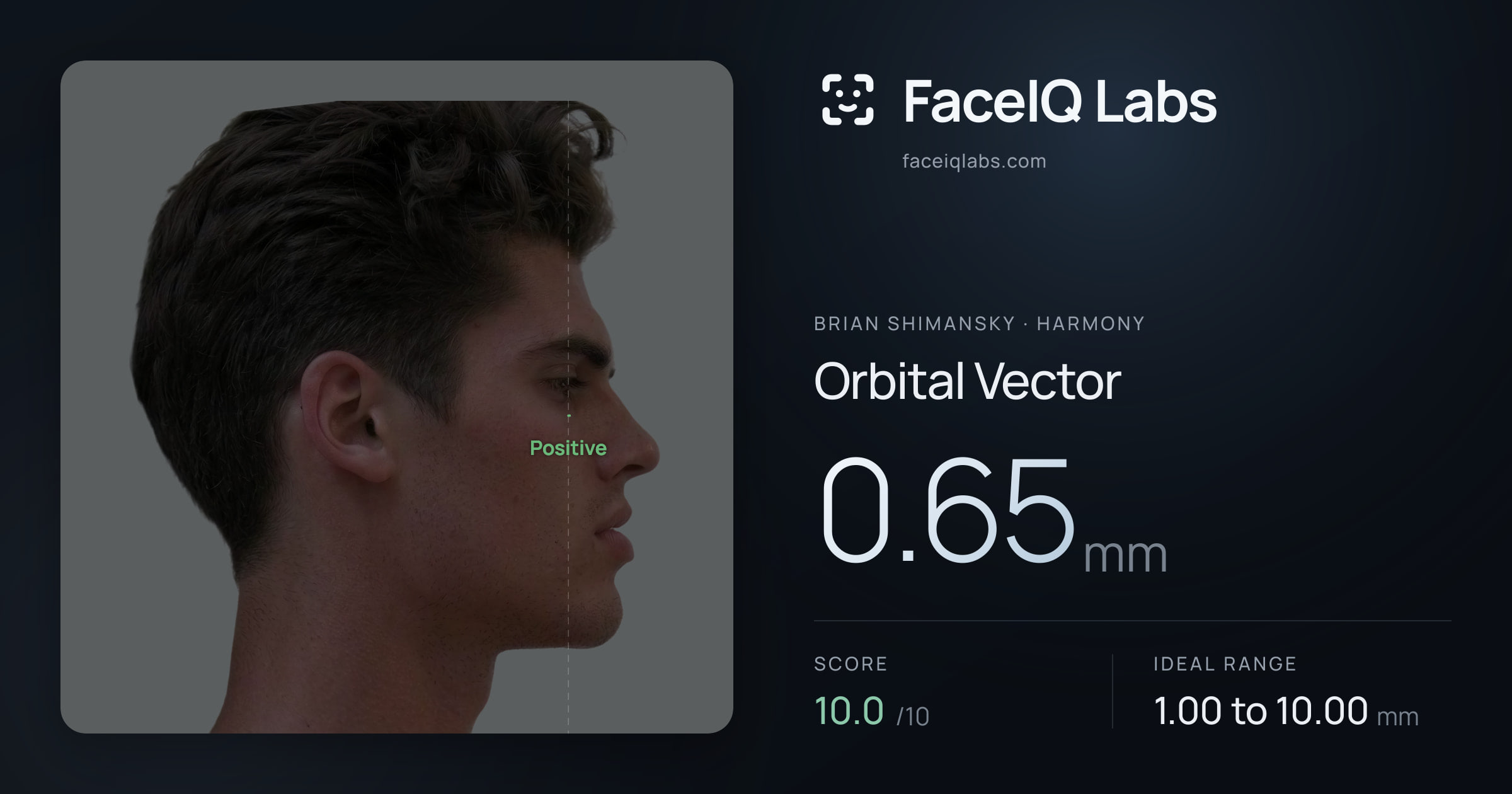 Brian Shimansky Orbital Vector: 0.65mm, drawn on the photo