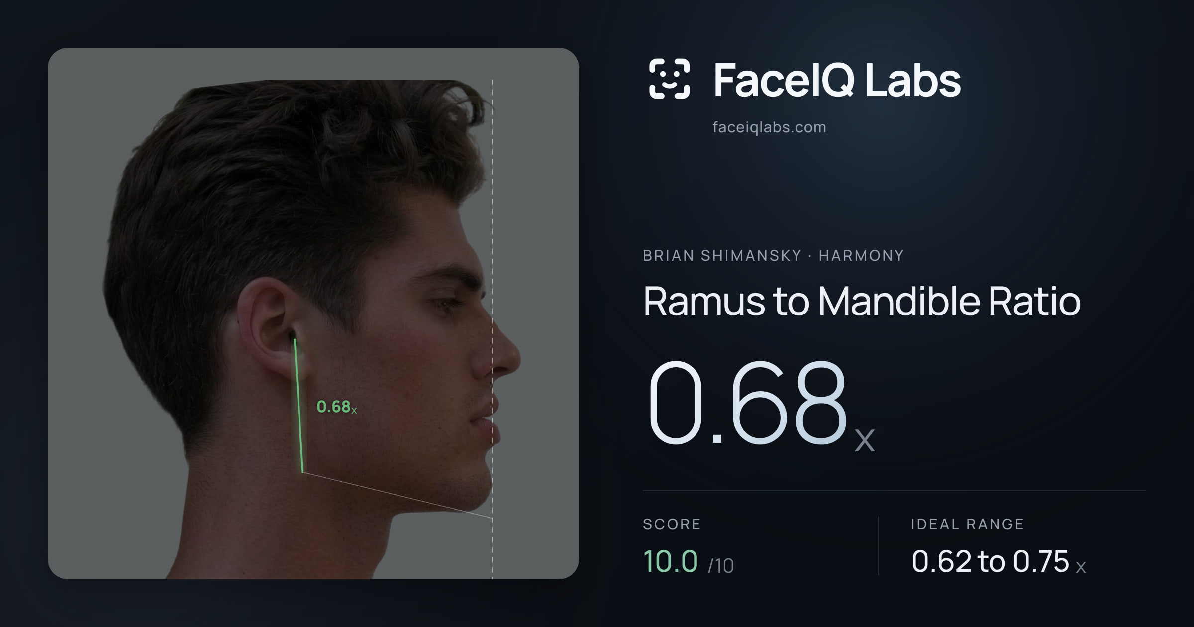 Brian Shimansky Ramus to Mandible Ratio: 0.67x, drawn on the photo