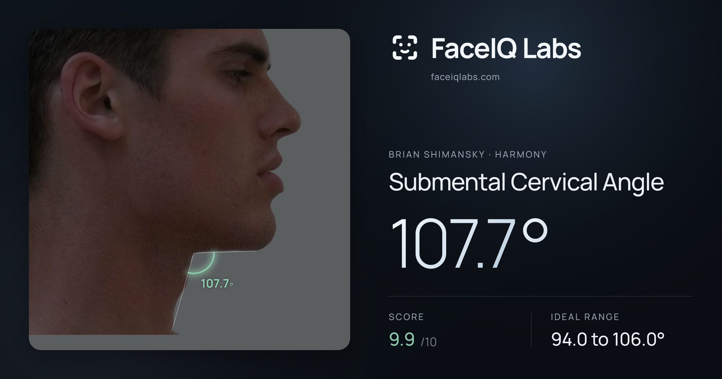Brian Shimansky Submental Cervical Angle: 110.2°, drawn on the photo