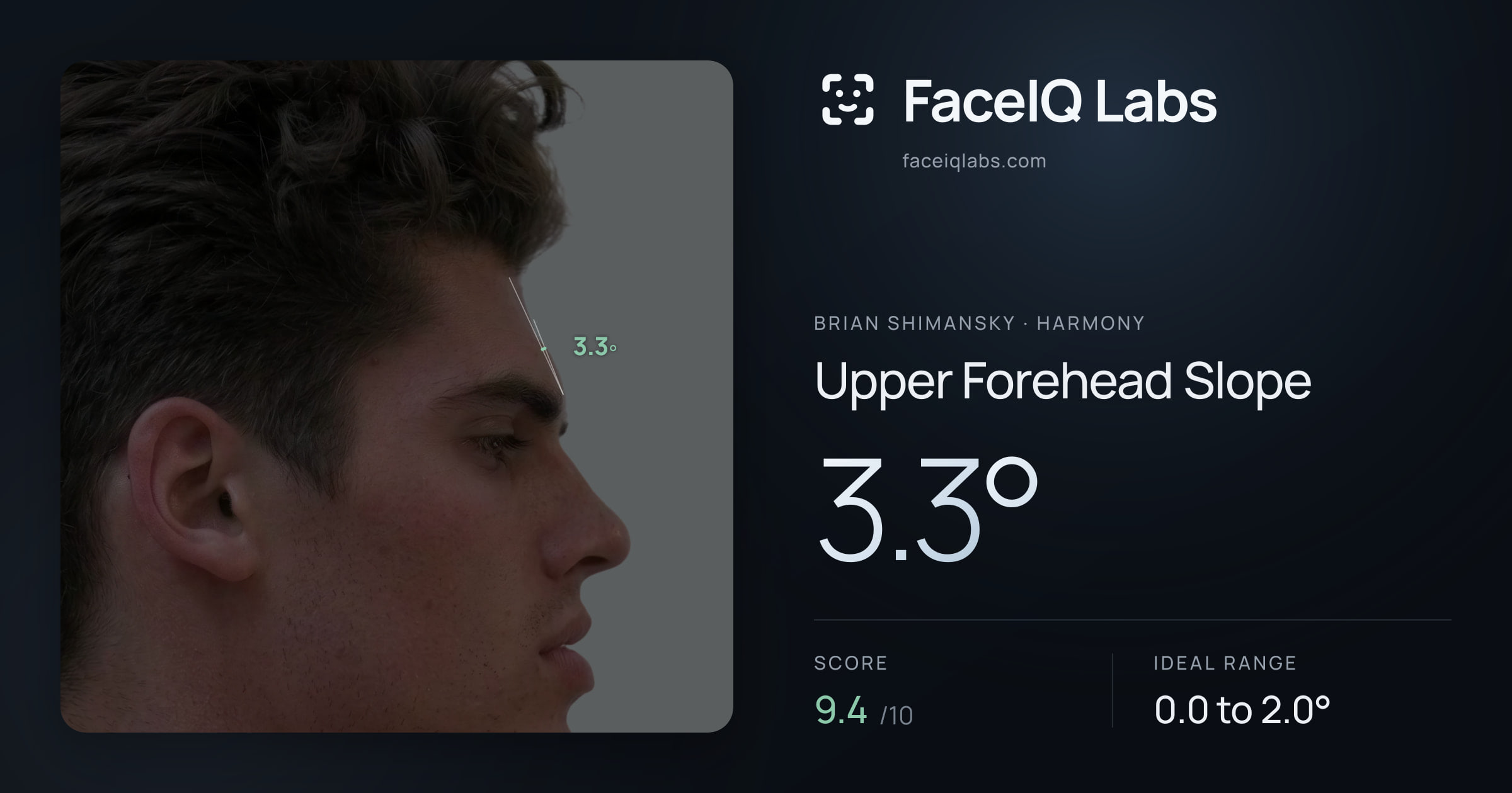 Brian Shimansky Upper Forehead Slope: 3.3°, drawn on the photo