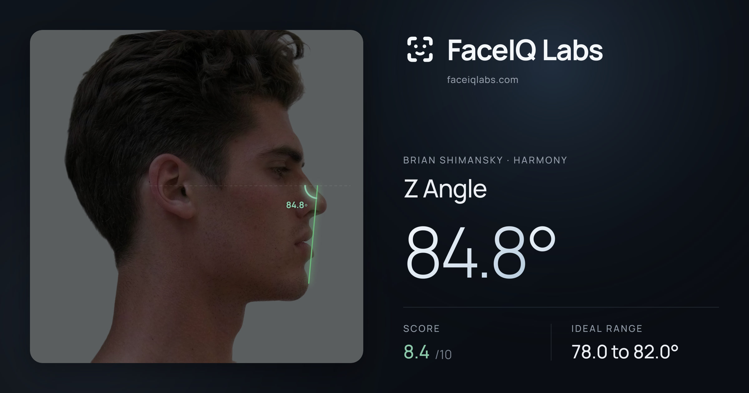 Brian Shimansky Z Angle: 83.1°, drawn on the photo