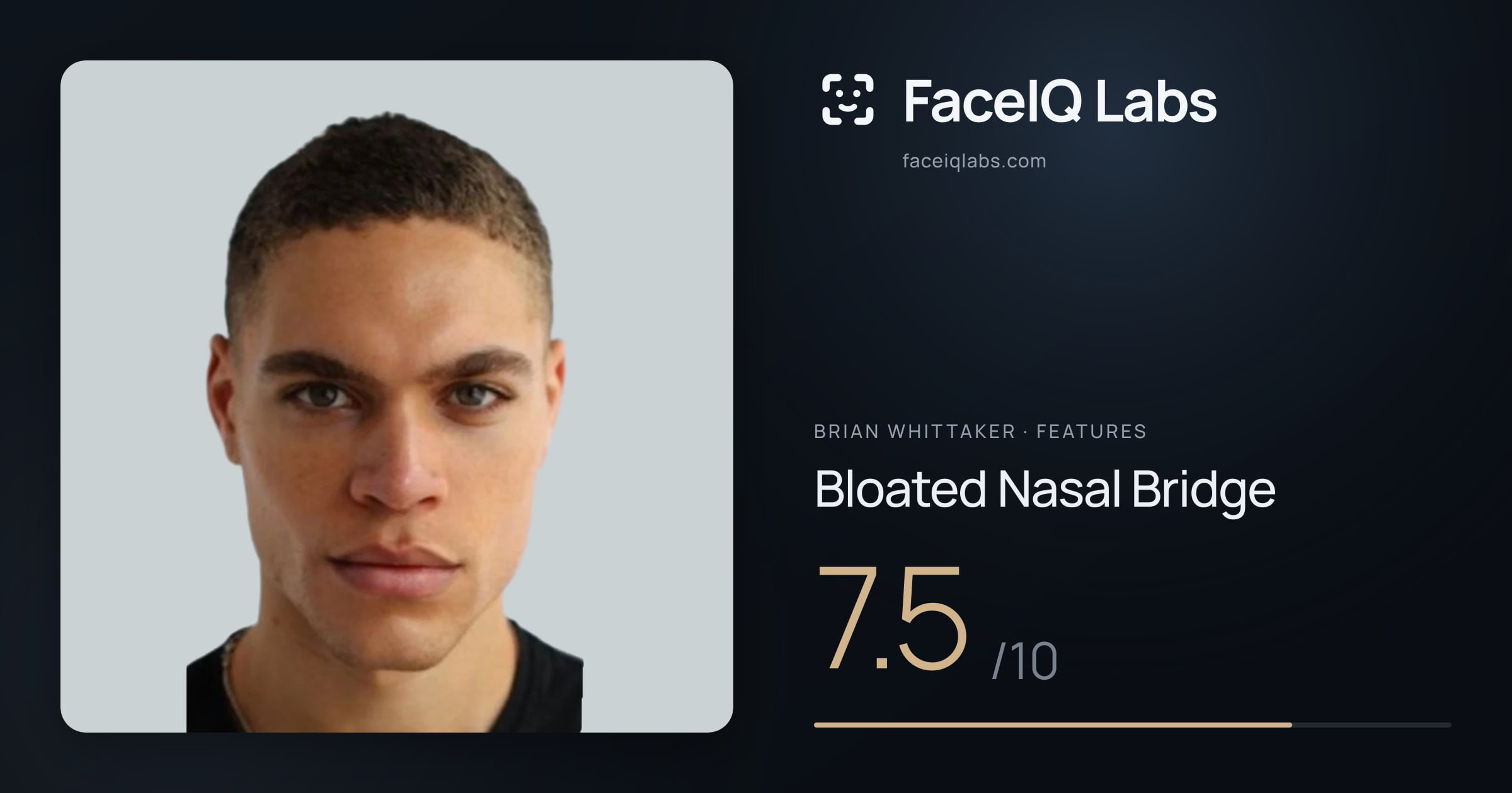 Brian Whittaker Bloated Nasal Bridge: 7.5/10, drawn on the photo