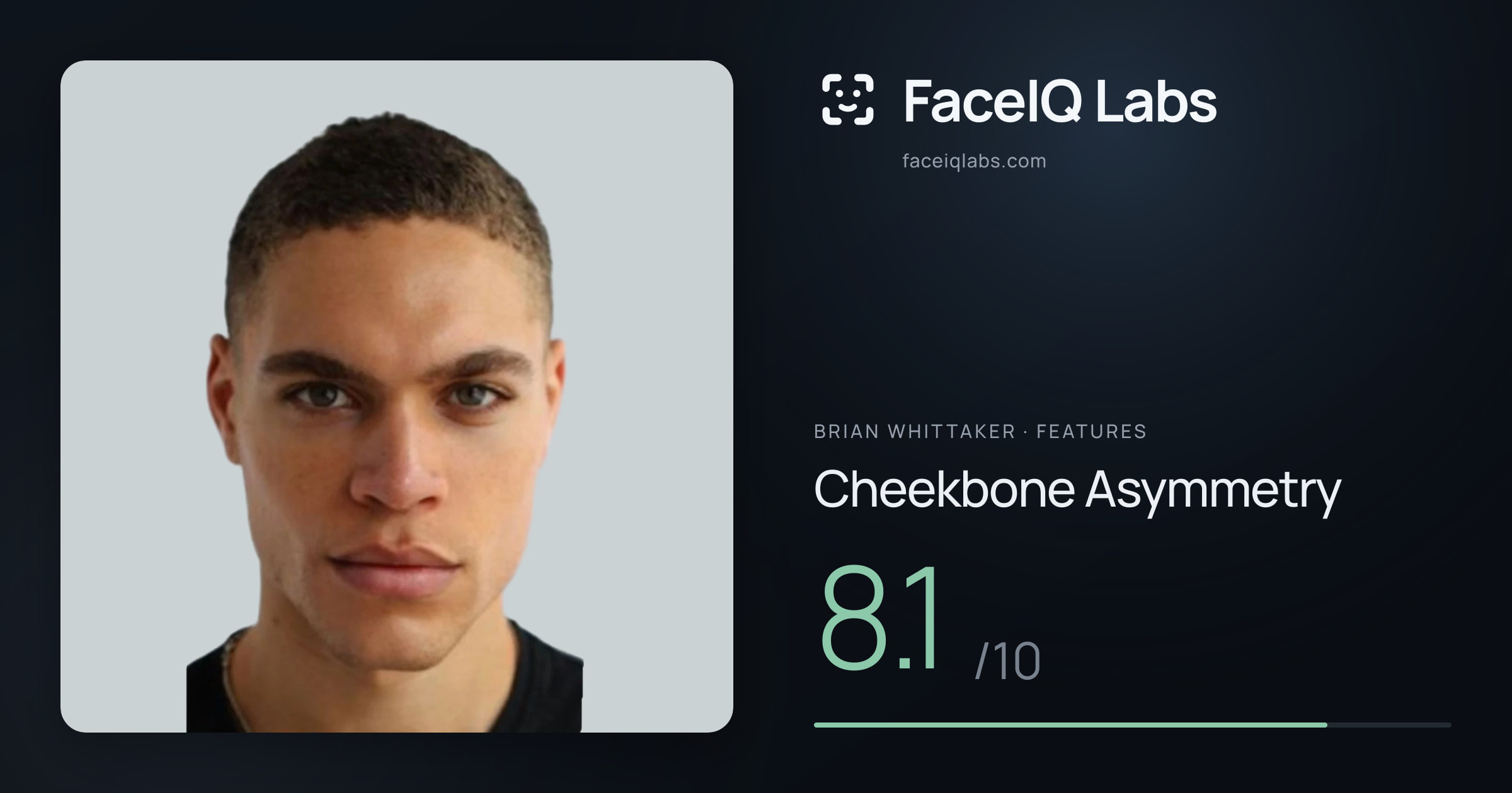 Brian Whittaker Cheekbone Asymmetry: 8.1/10, drawn on the photo