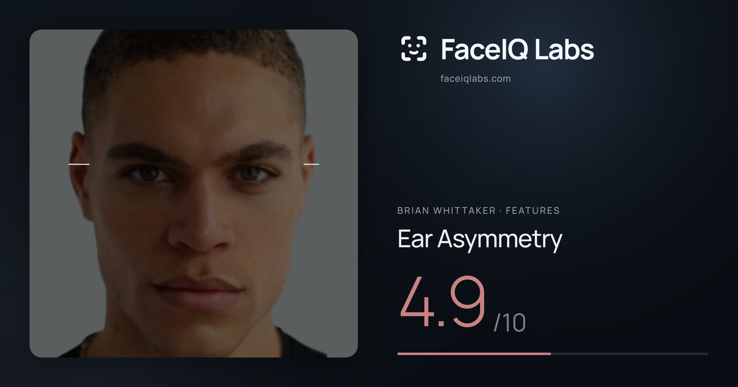 Brian Whittaker Ear Asymmetry: 4.9/10, drawn on the photo