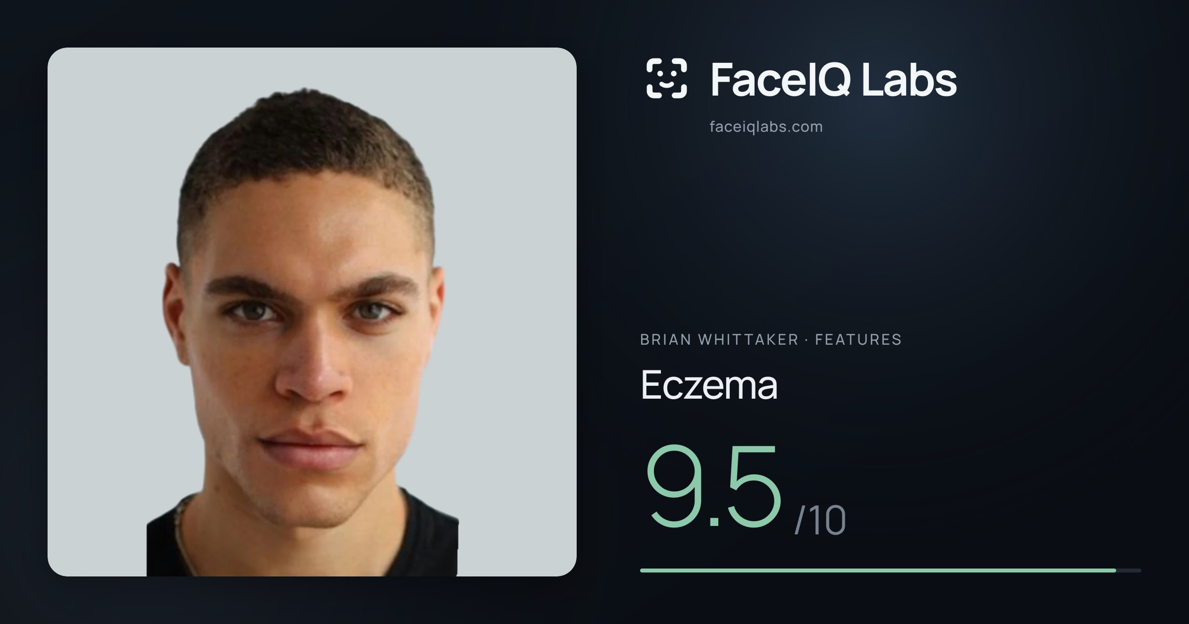 Brian Whittaker Eczema: 9.5/10, drawn on the photo