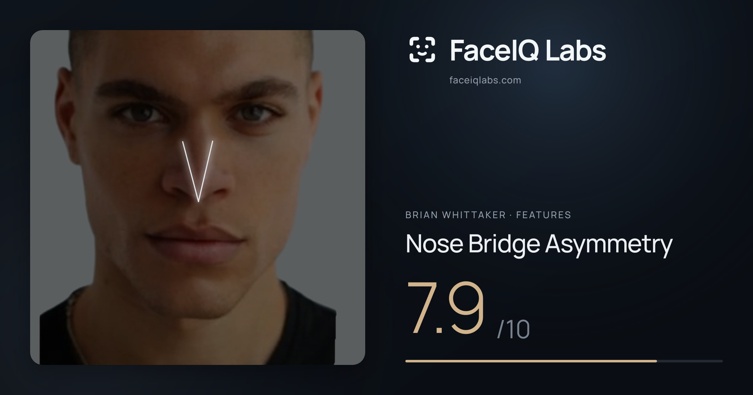 Brian Whittaker Nose Bridge Asymmetry: 7.9/10, drawn on the photo