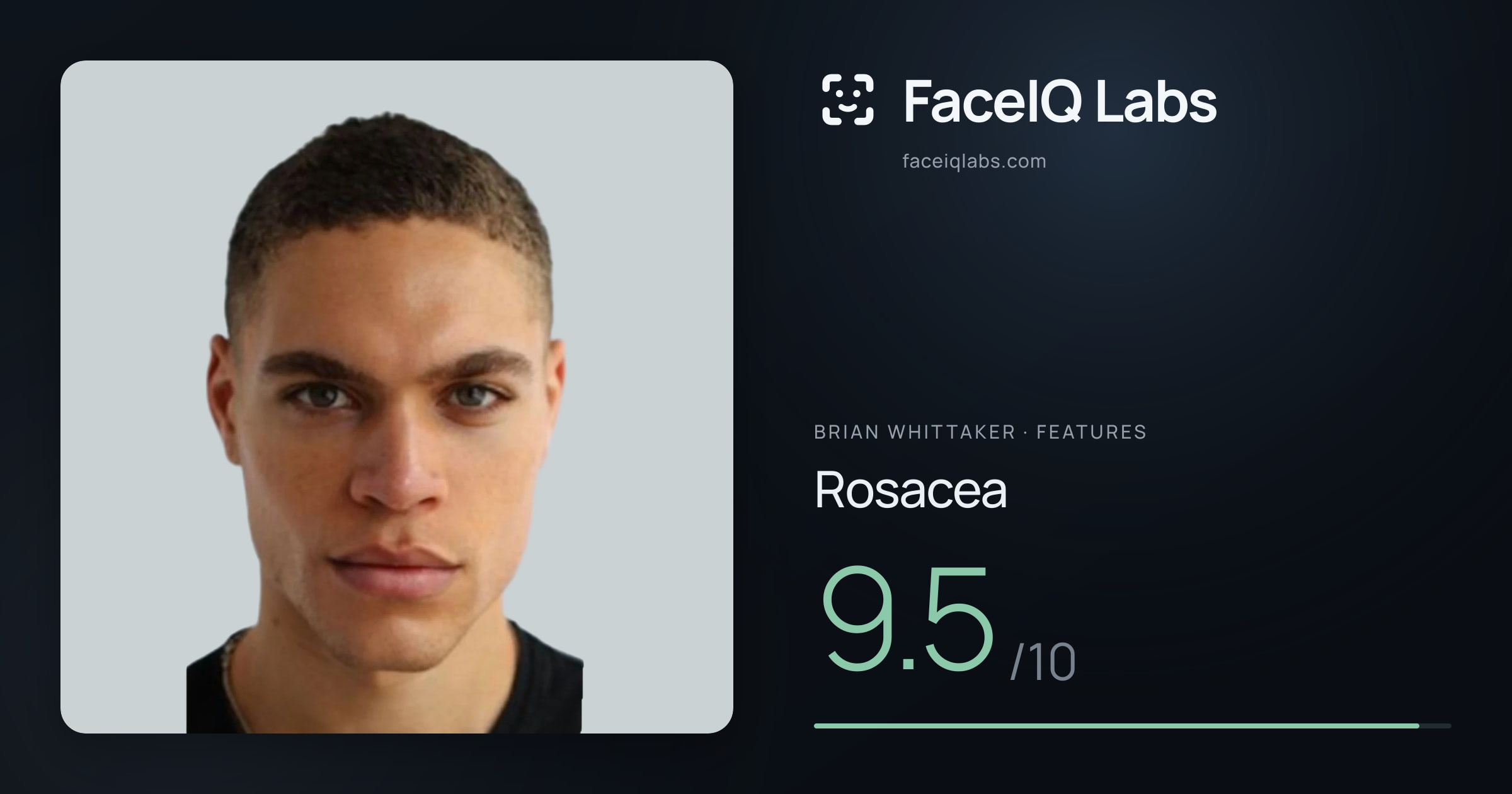 Brian Whittaker Rosacea: 9.5/10, drawn on the photo