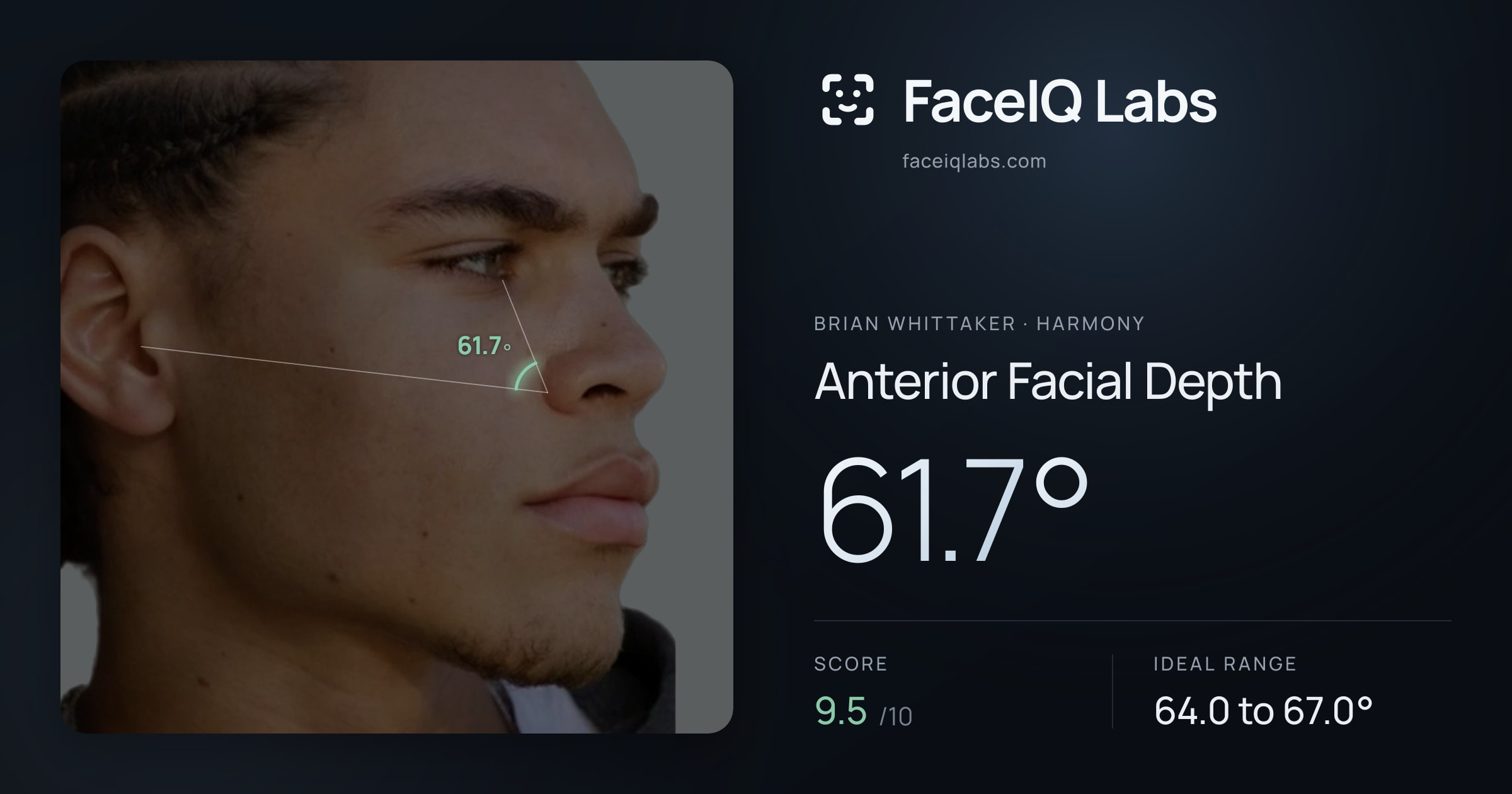 Brian Whittaker Anterior Facial Depth: 61.7°, drawn on the photo