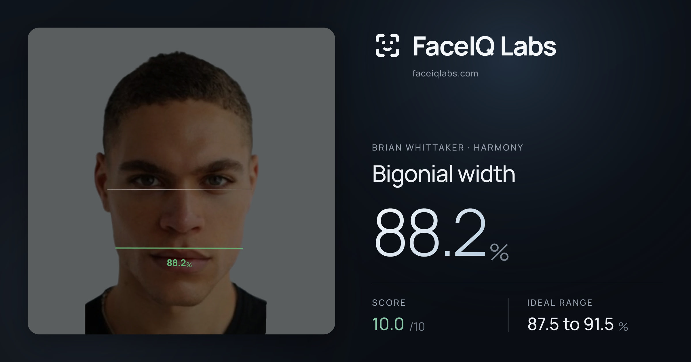 Brian Whittaker Bigonial width: 88.2%, drawn on the photo