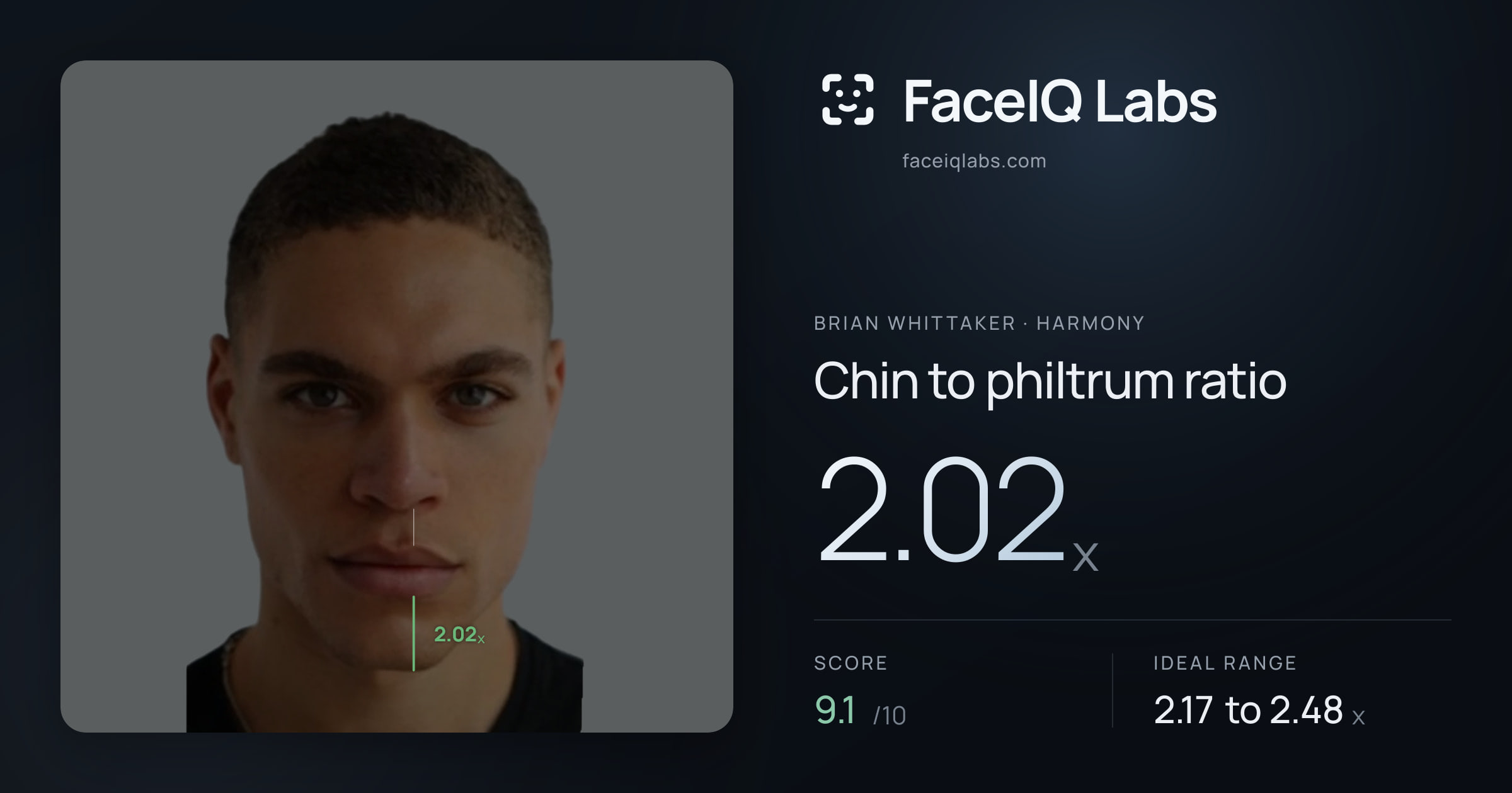 Brian Whittaker Chin to philtrum ratio: 2.02x, drawn on the photo