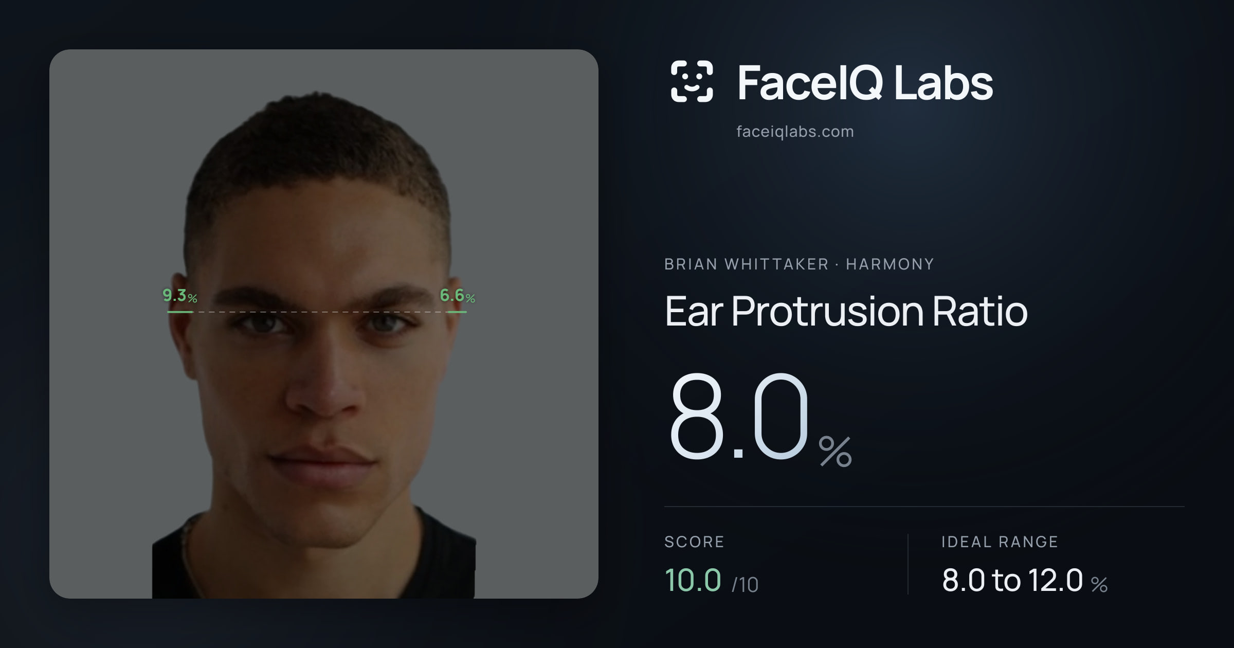 Brian Whittaker Ear Protrusion Ratio: 8.0%, drawn on the photo