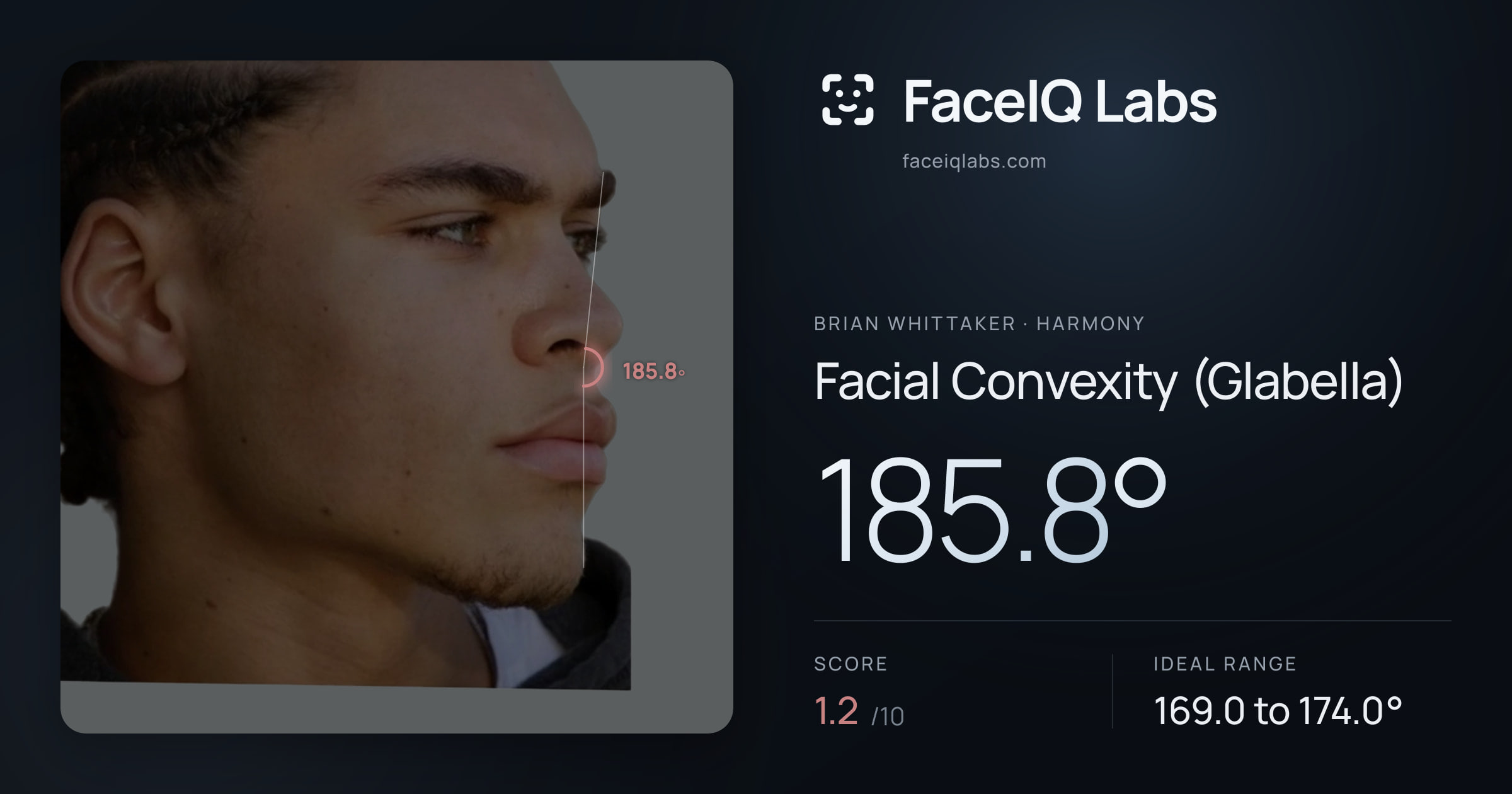 Brian Whittaker Facial Convexity (Glabella): 185.8°, drawn on the photo