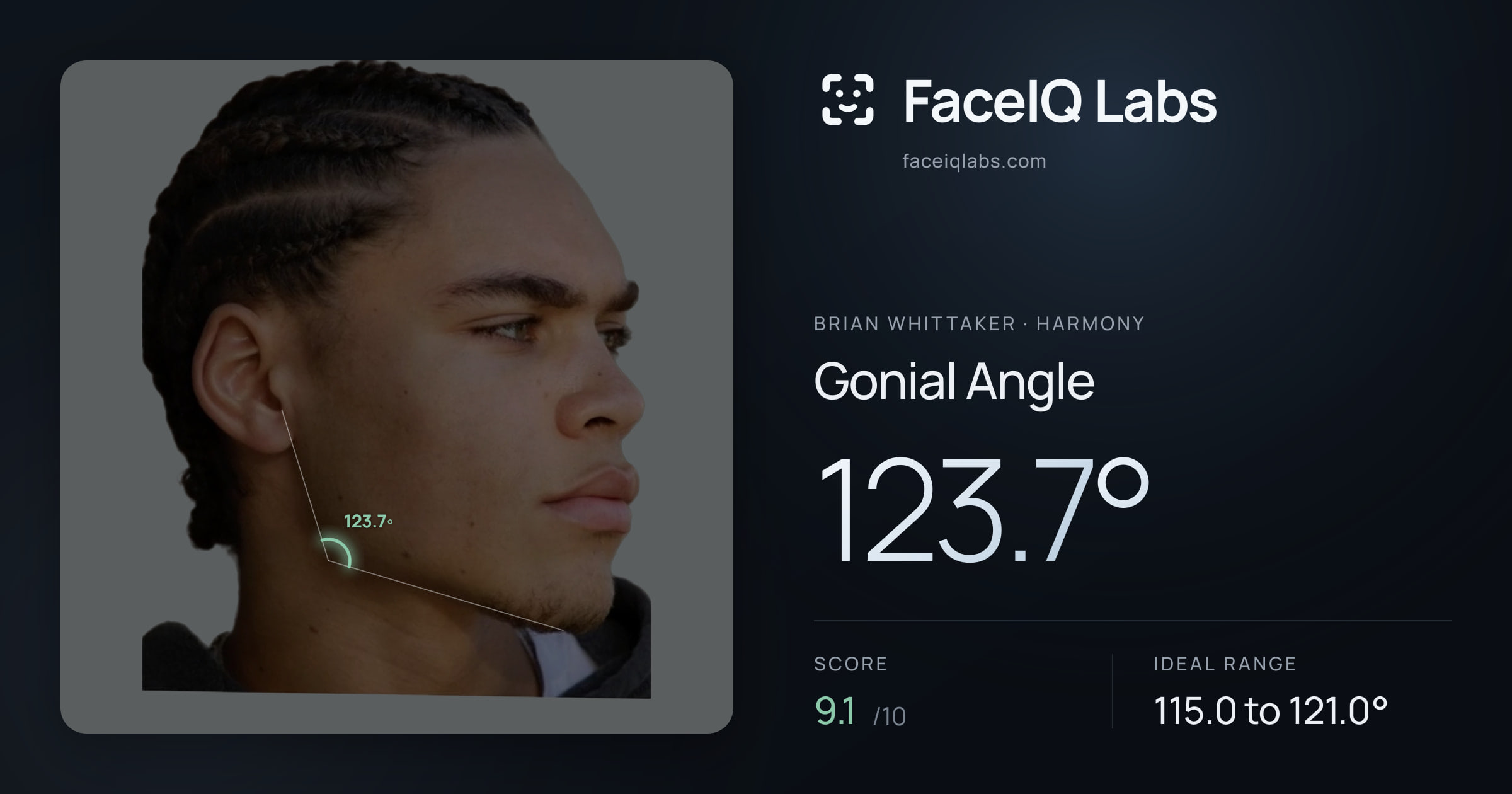 Brian Whittaker Gonial Angle: 123.7°, drawn on the photo