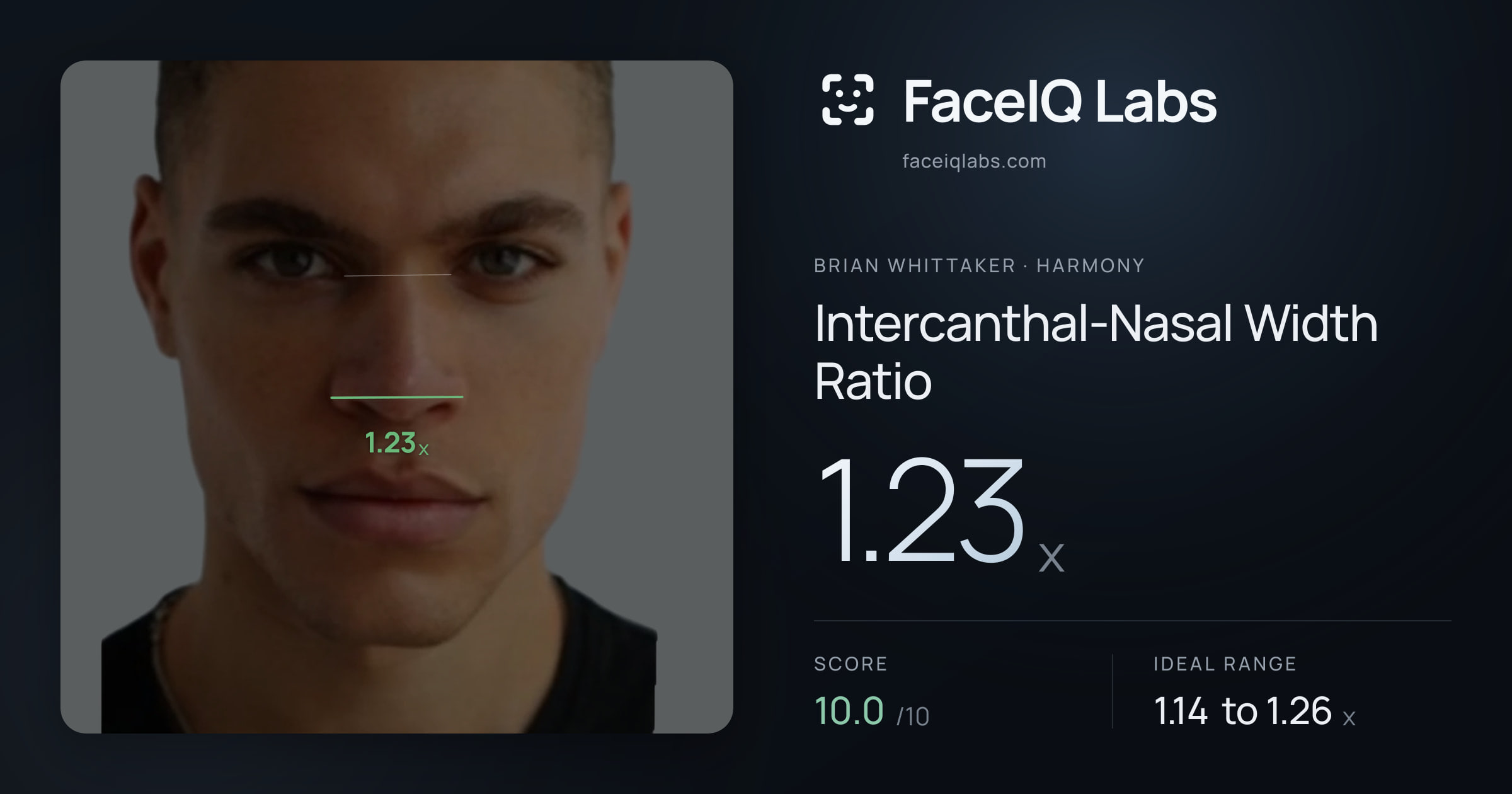 Brian Whittaker Intercanthal-Nasal Width Ratio: 1.23x, drawn on the photo